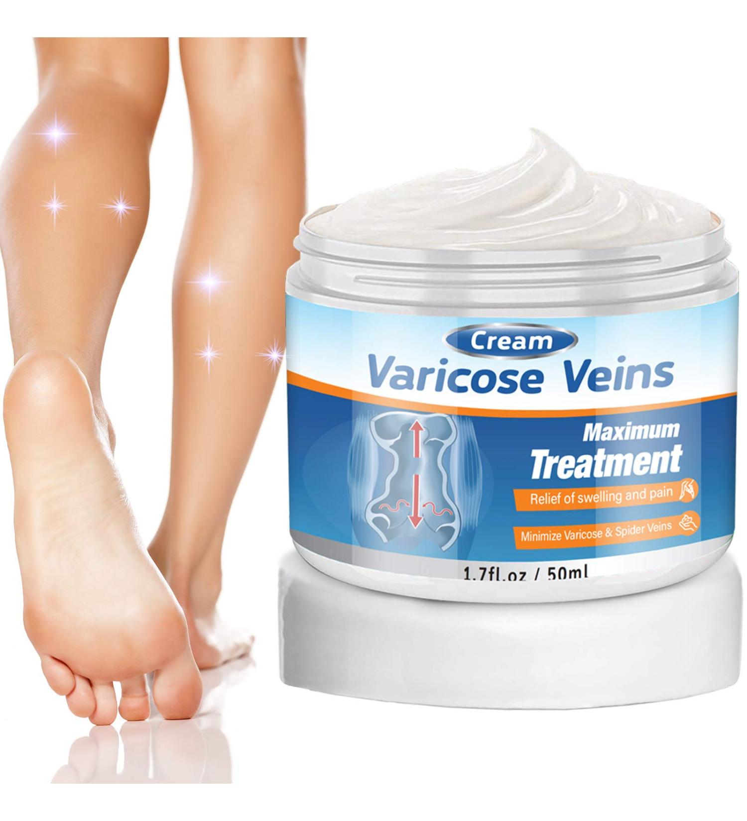 Varicose Veins Cream - Effective Treatment for Leg Relief, Phlebitis & Circulation Improvement (1.7 Fl Oz) - Buy Online on GoSupps.com