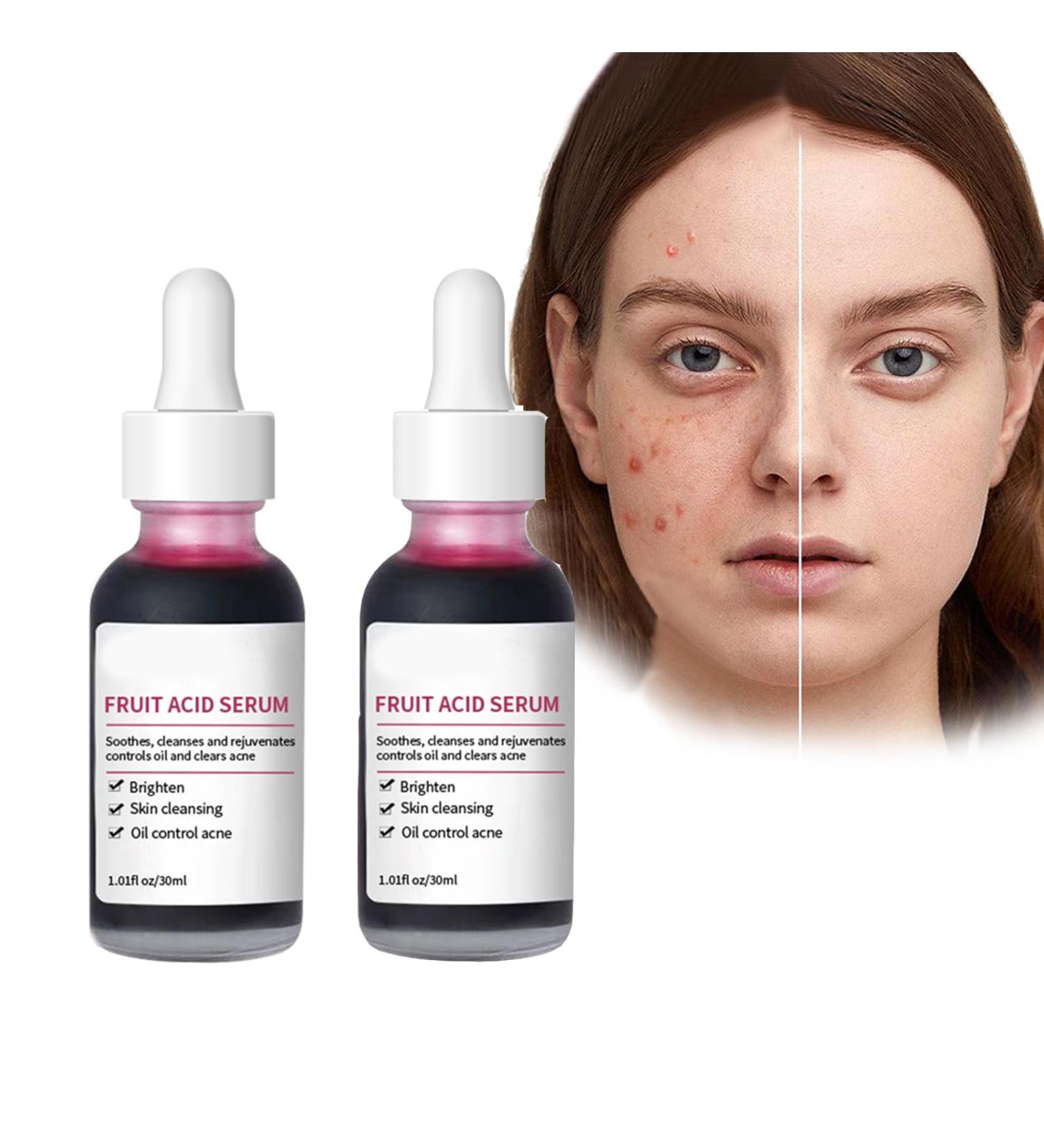  Pemarlis 2PCS Brightening Serum to Remove Dark Spots Oil Corrective Serum for Face and Body for Skin Treatment Against Acne and Pimple Marks - Buy Online on GoSupps.com