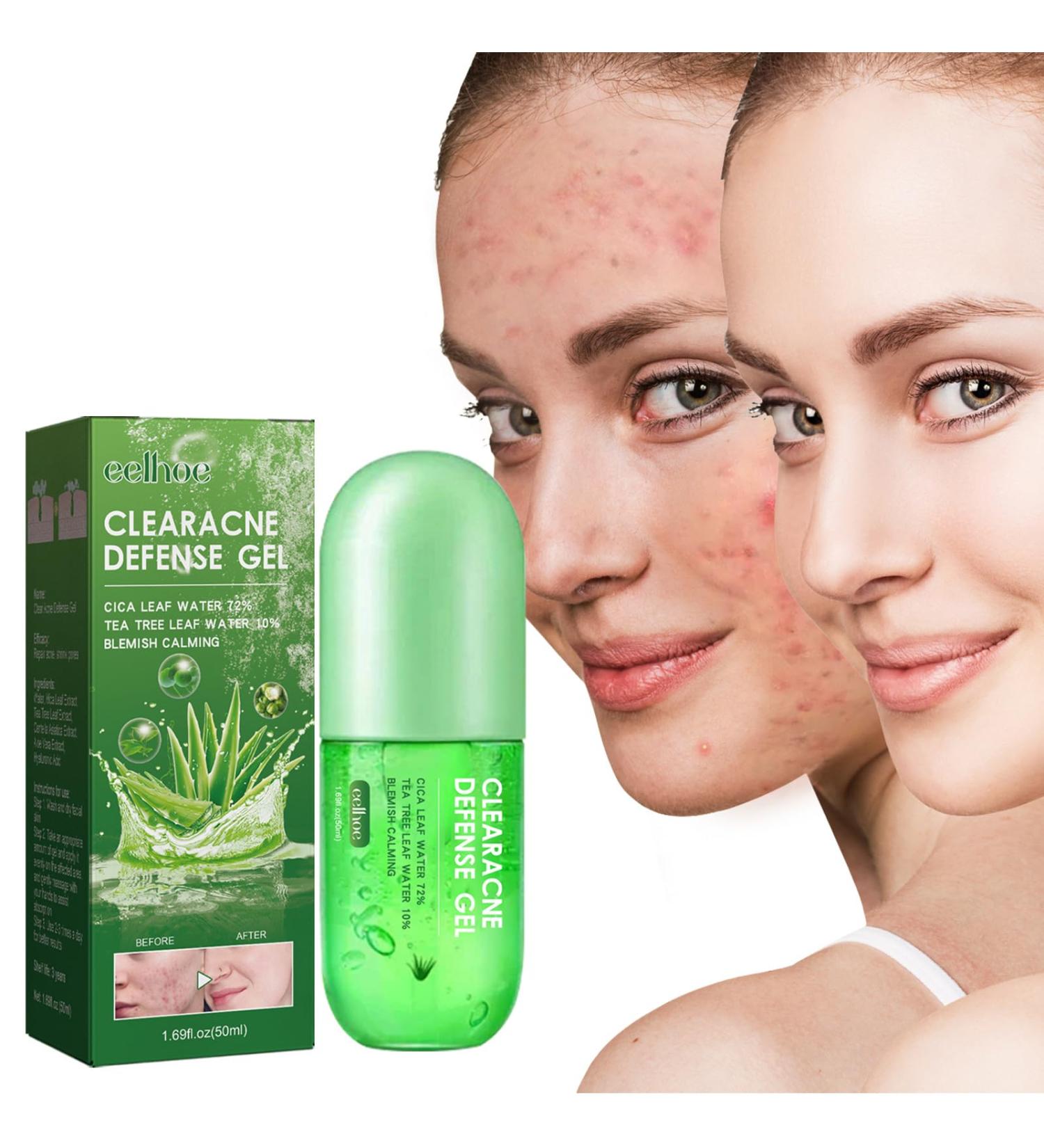 Acne Repair Gel Fade Acne Closure Acne Improve Acne Skin Moisturizing Facial Treatment - Buy Online on GoSupps.com