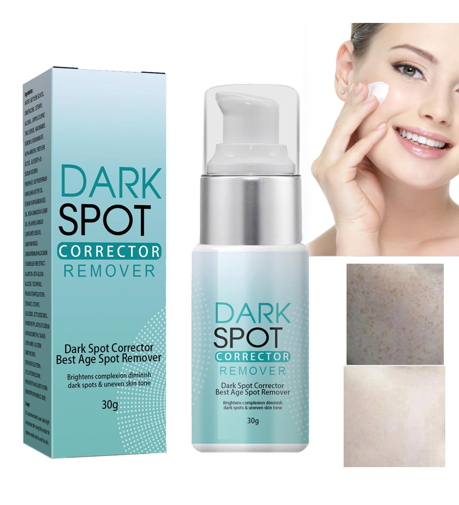 KOAHDE Black Spot Removing Cream Whitening and Freckle Removing Face Cream Spot Lightening Face Cream Dark Spot Corrector Creams Dark Spot Removing Moisture Cream Spot Skin Repairing Face Cream - Buy Online on GoSupps.com