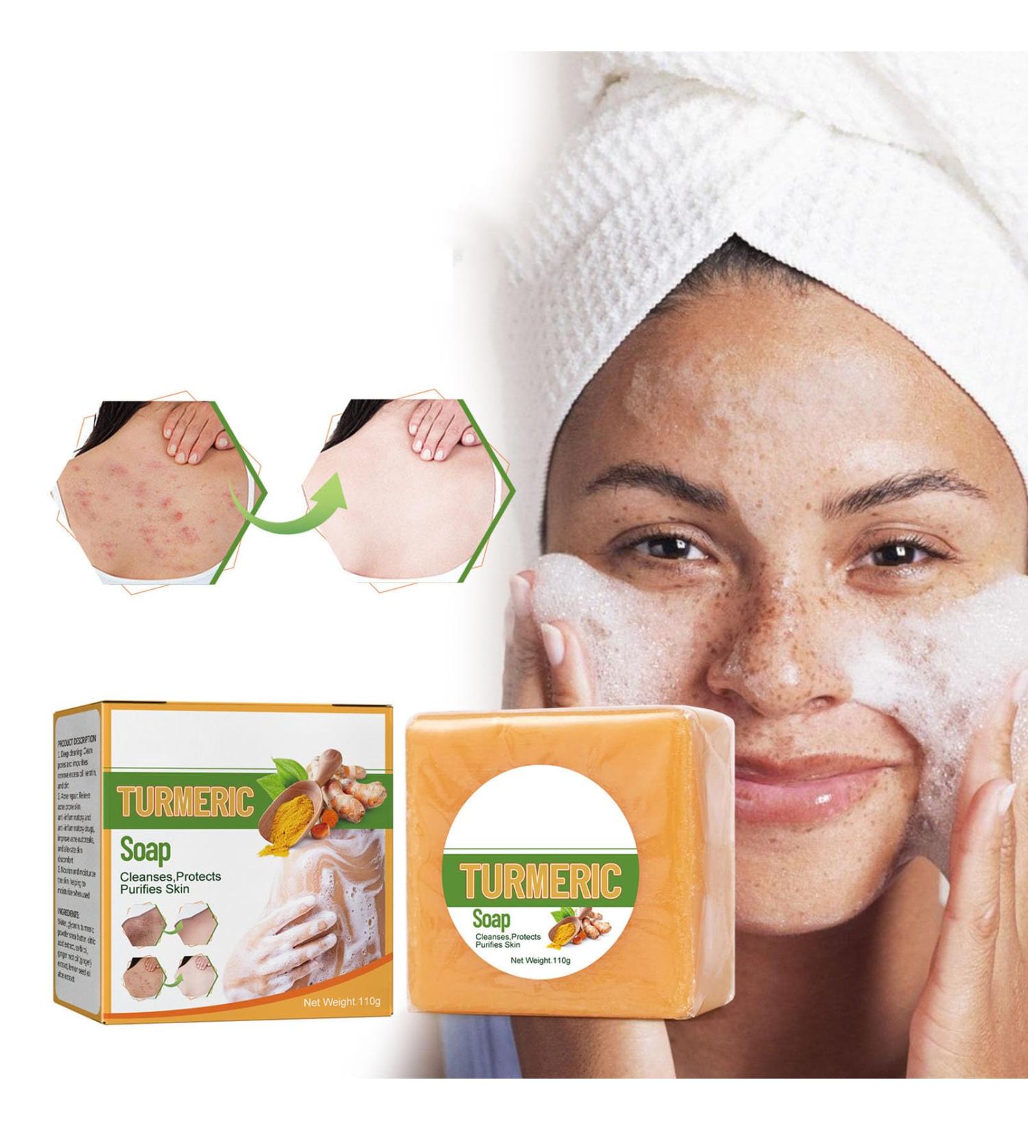 Nmbol Skin Turmeric Soap Cojic Acid Soap For Skin Lightening Kurkuma Soap Lightening Solid Facial Soap Handmade Organic Natural Soap Soap For Dark Spots Hyperpigmentation Smooth Skin - Buy Online on GoSupps.com