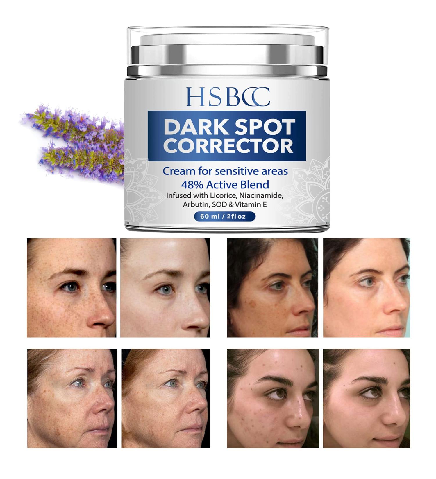 Dark Spot Remover for Face - Arbutin, Niacinamide & Vitamin E Formula - 2 Fl Oz - Buy Online on GoSupps.com