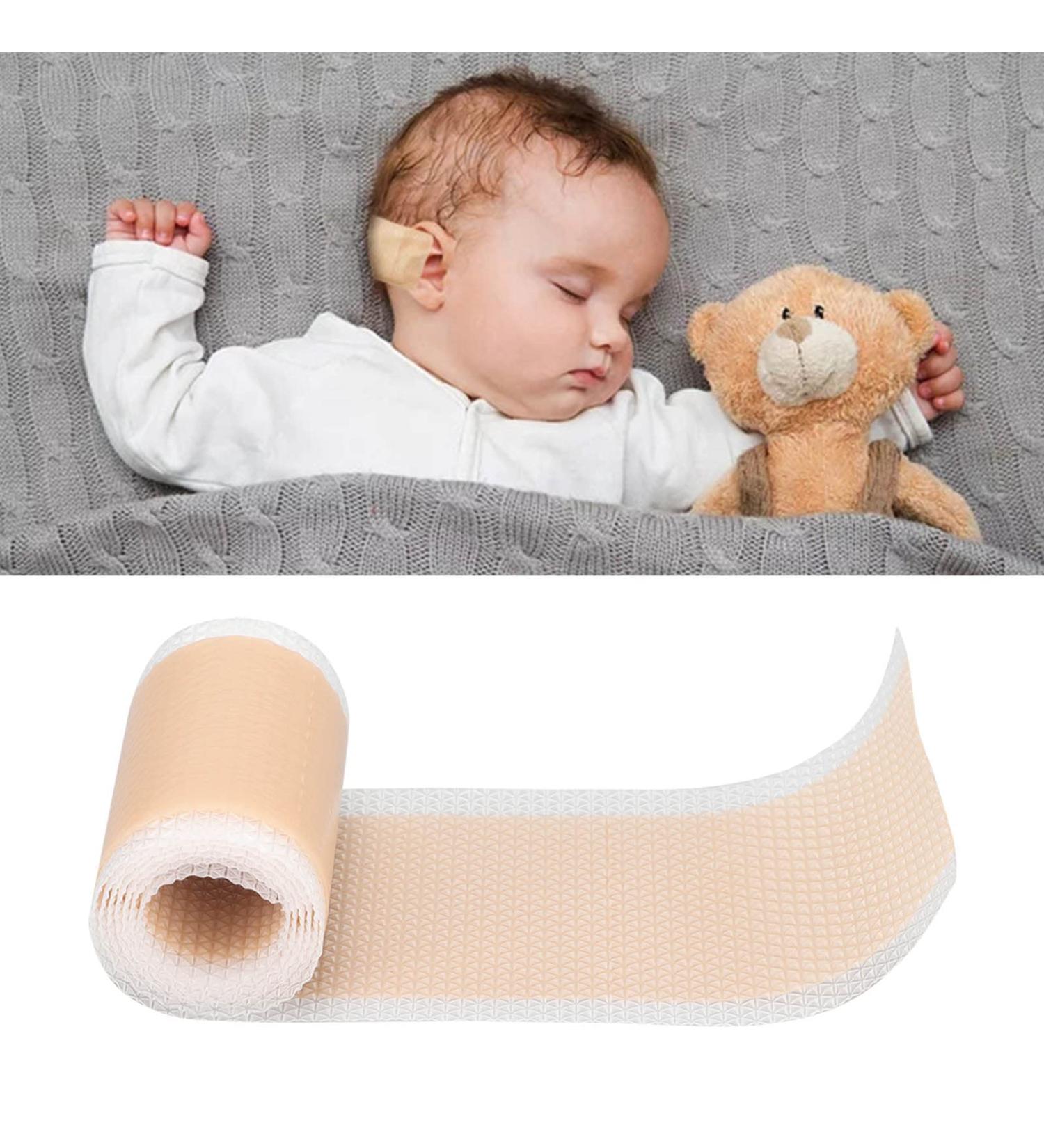 Baby Ear Pad Correction Patch - Silicone Adhesive for Newborn Ear Valgus Correction - Buy Online on GoSupps.com