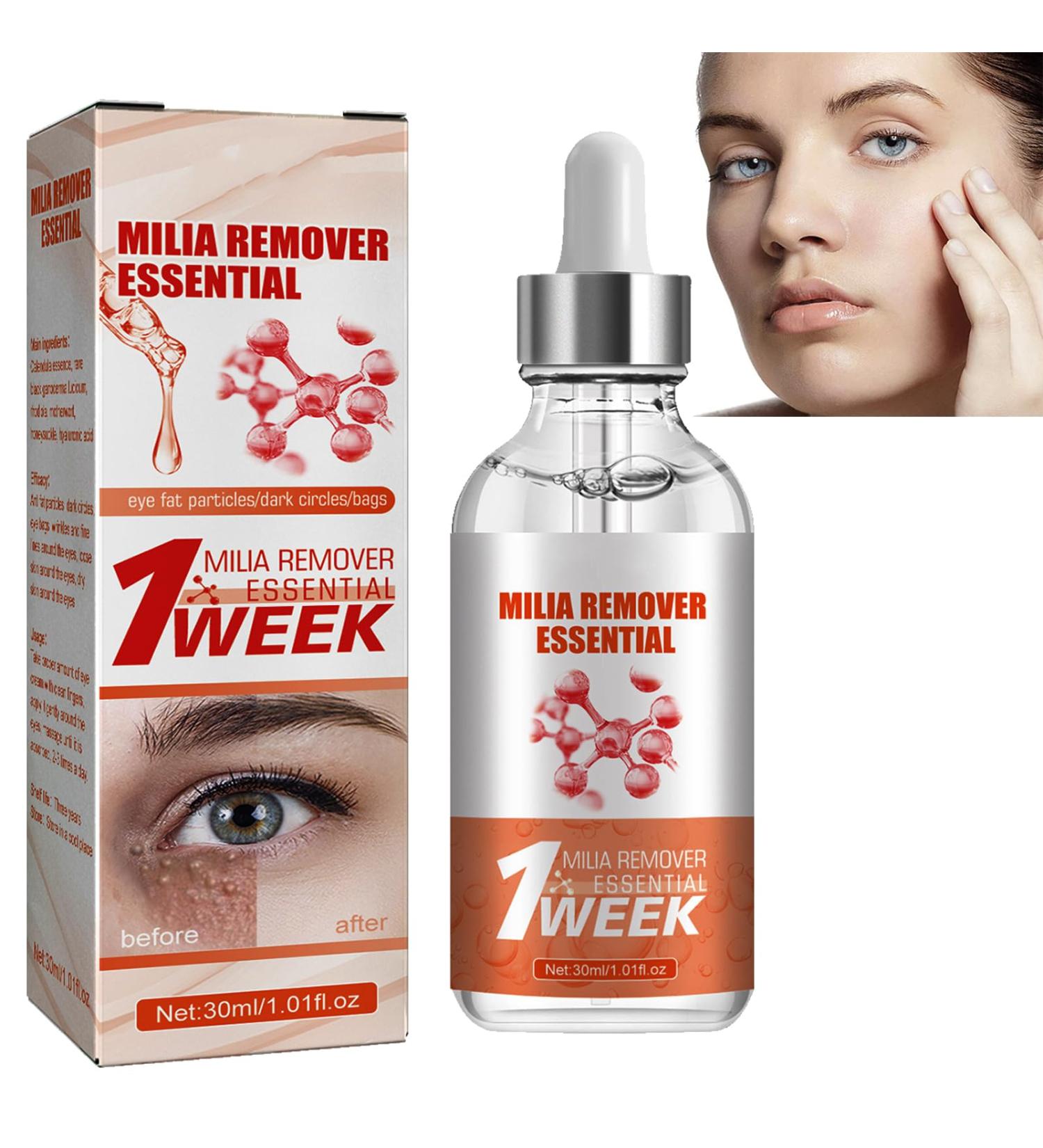 KOAHDE Milia Removal Face Serums Milia Spot Treatment Milia Treatment Spot Remover for Face Speedy Milia Remover Milia Spot Ruduce Face Serums Dark Spot Remover Face Serum Milia Removal Spot Care - Buy Online on GoSupps.com