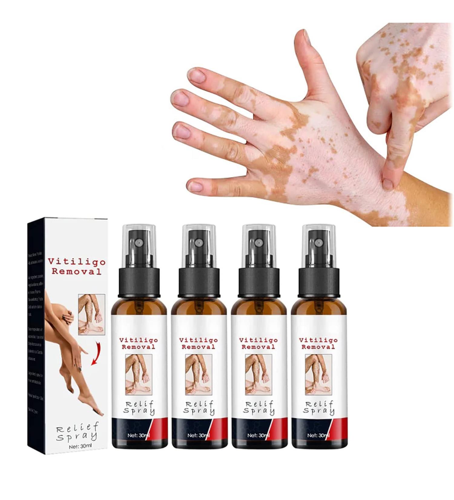 DUBUSH Vitiligo Kalmerende Spray Vitiligo Skin Repair Spray - Buy Online on GoSupps.com