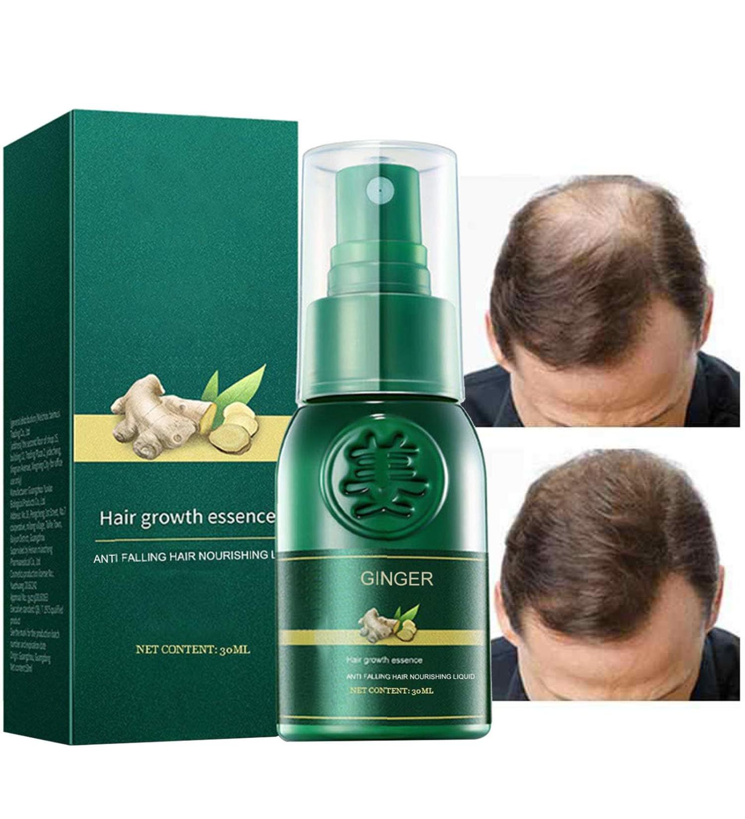 Joyivike 2 Hair Oil Mist Ginger Oil 30ML Hair Oil Mist Grows Hair Thicker Longer Accelerates Hair Growth for Men - Buy Online on GoSupps.com