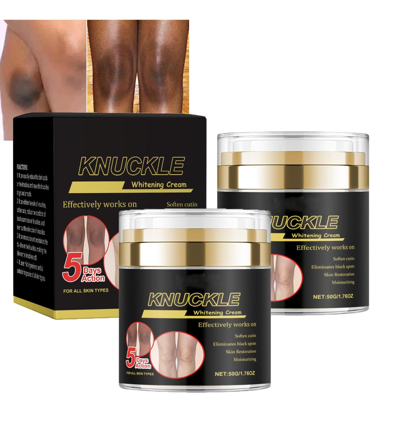 Skin Care 5days Dark Knuckle Remover Whitening Cream Anti Spot Face Cream Dark Spot Correcting Serum- Skin Brightening Gel Cream for Sun Spots with Hyaluronic Acid Vitamin E (2) - Buy Online on GoSupps.com