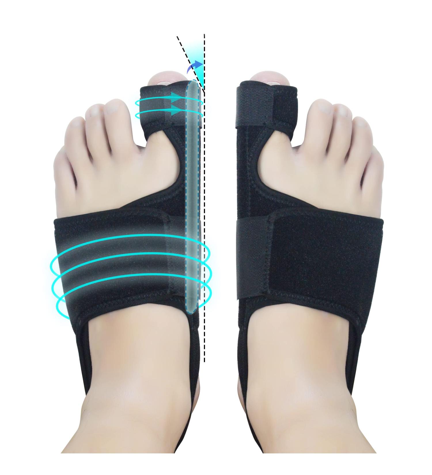 Shop Bunion Corrector - Effective Bunion Toe Corrector (1 Pair) for Pain Relief | International Shipping Available - Buy Online on GoSupps.com