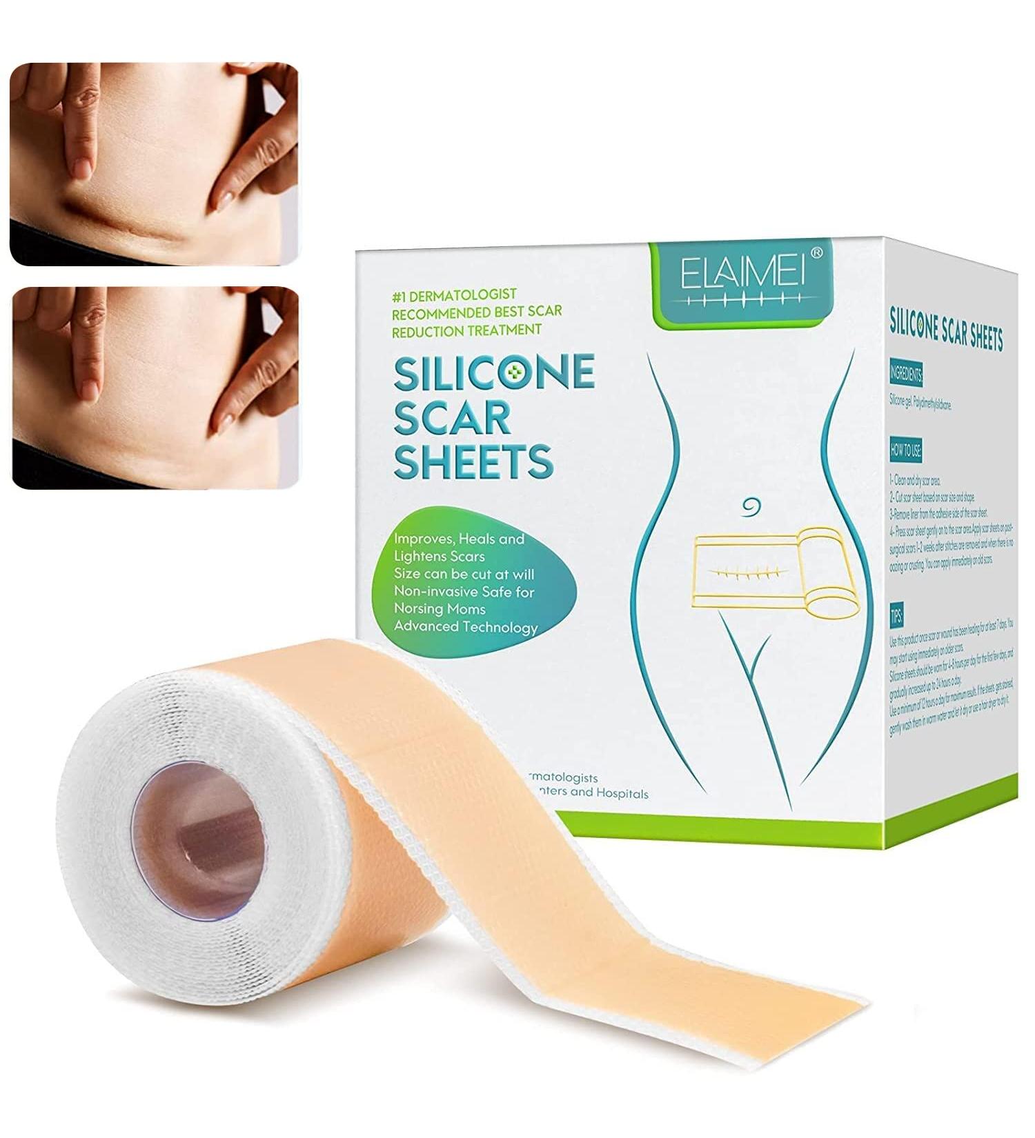 Silicone Scar Tape 1.6 x 60 Inch - Medical Grade Treatment for Surgery, C-Section, Keloid & Burn Scars - Safe & Painless Removal Strips - Buy Online on GoSupps.com