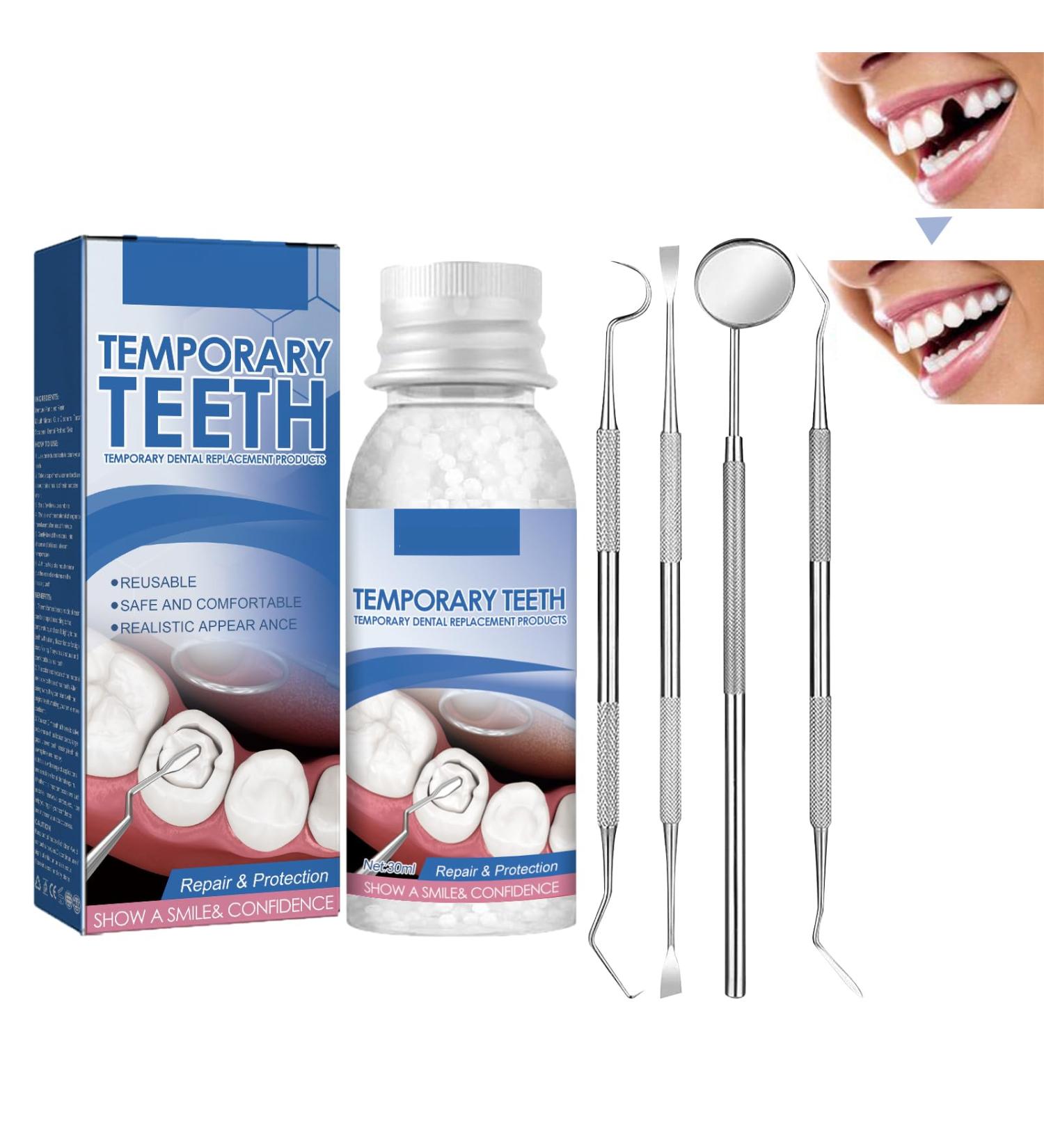 Temporary Tooth Repair Kit | Instant Dental Repair Set for Missing & Broken Teeth | Prosthesis Veneers & Granules - Buy Online on GoSupps.com