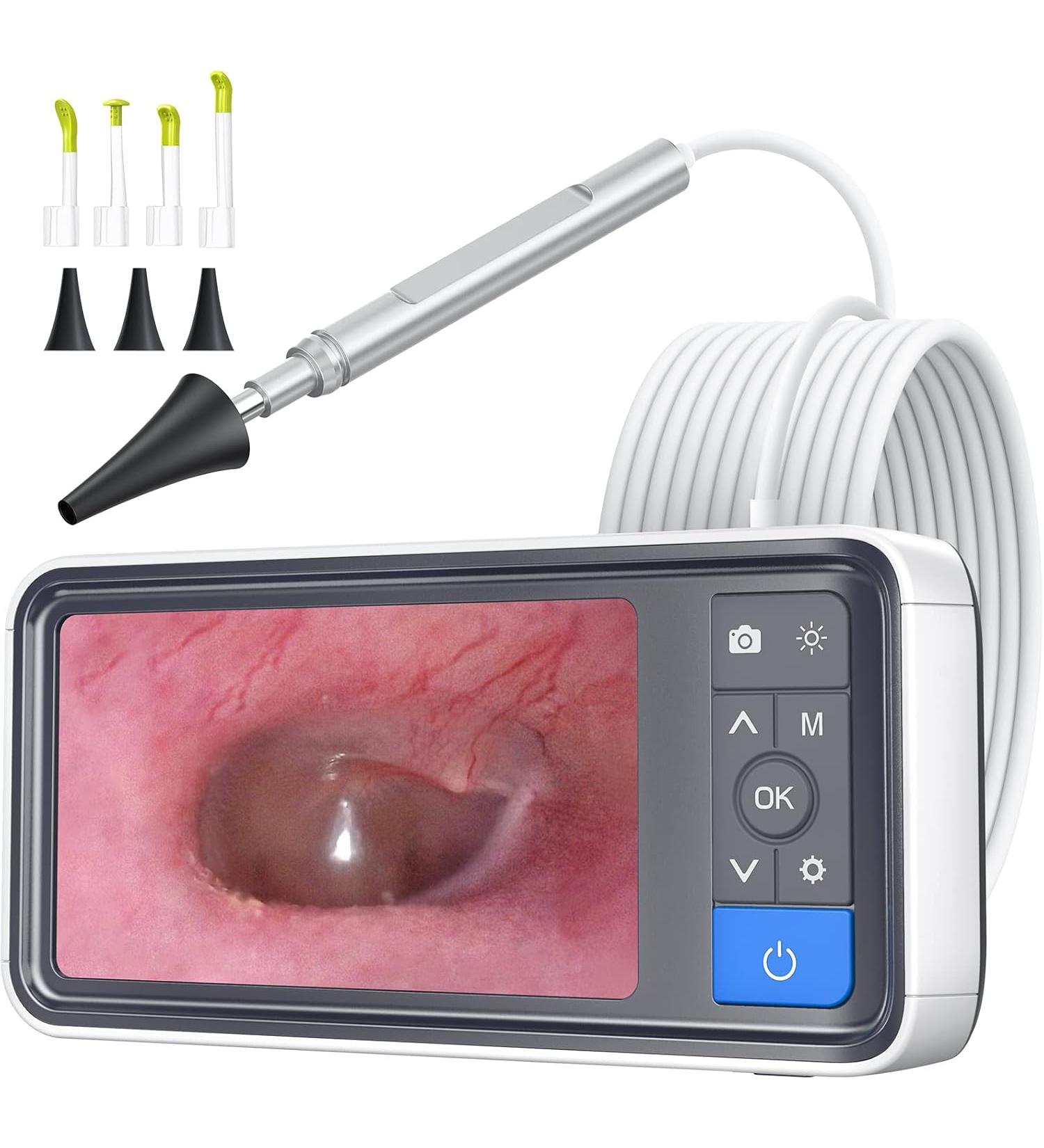 ScopeAround Ear Wax Removal Camera - 4.5 IPS Screen, 1920x1080 FHD Smart Visual Ear Cleaner - Plug & Play Home Ear Infection Detector & Remover - Buy Online on GoSupps.com