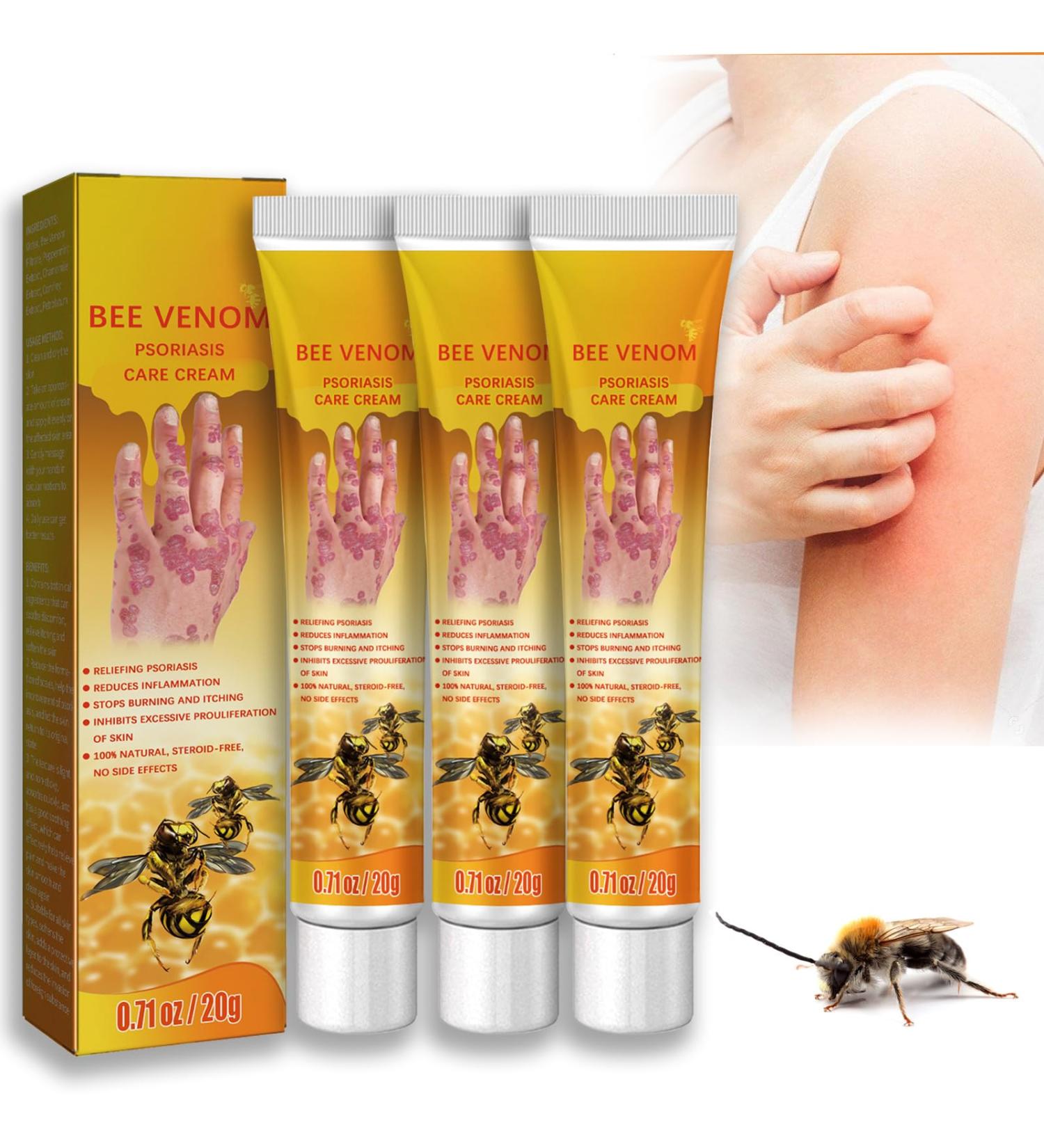 New Zealand Bee Venom Psoriasis Treatment Cream - Soothing & Moisturizing for All Skin Types (3pcs) - Buy Online on GoSupps.com