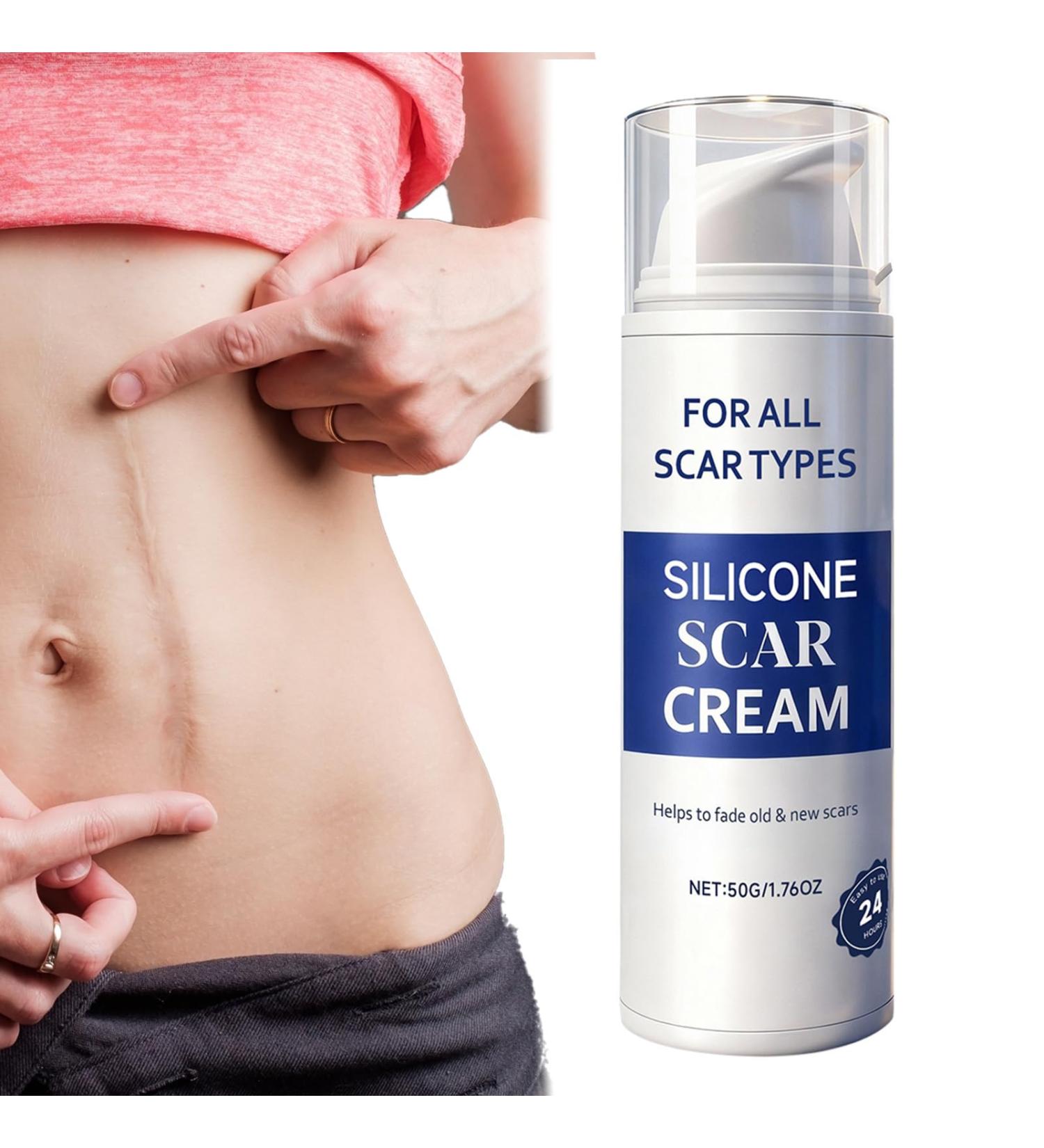 Burn Scar Removal Cream | 50g Nourishing Corrector | Nourishing and Moisturizing Treatment for Scars - for Body Marks Sun Spots Stretch Marks and Post-Pregnancy Skin - Buy Online on GoSupps.com