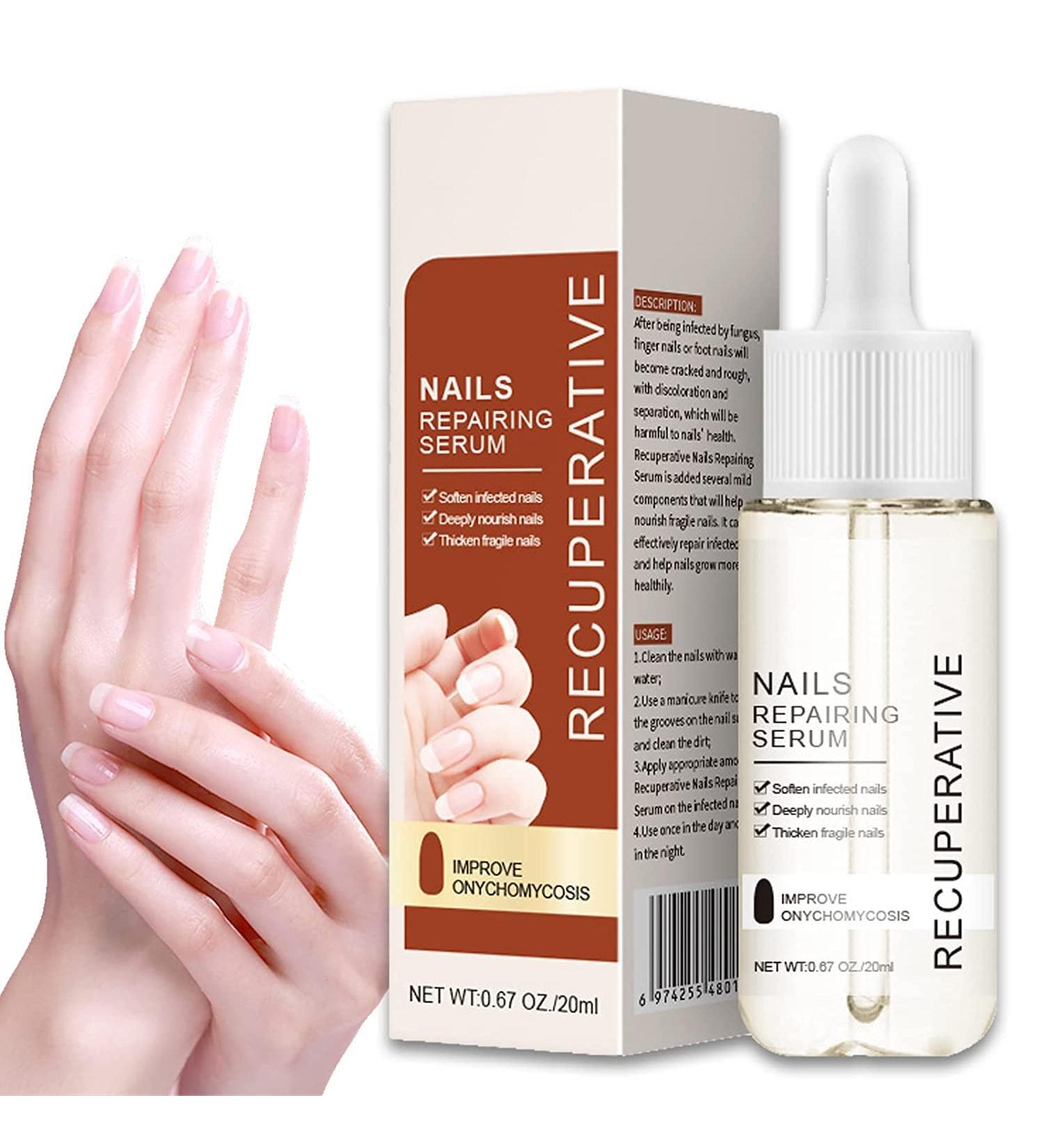 GFOUK 7 Days Nail Growth And Strengthening Serum Nail Growth and Strength Serum Nail Growth & Strengthening Oil Serum Stronger Nails in 1 Week Nail Strengthening Treatment (1 Pcs) - Buy Online on GoSupps.com