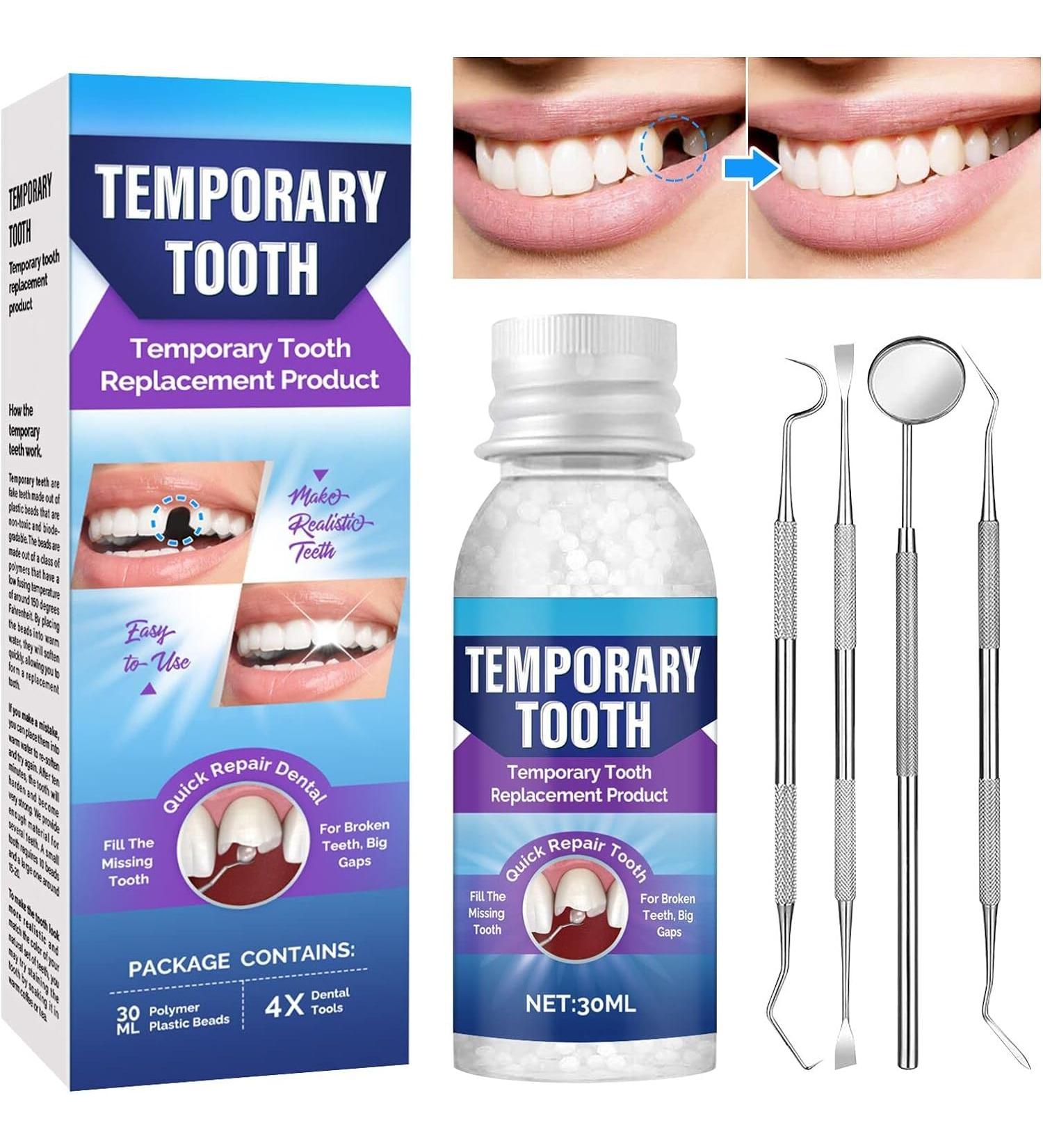 Tooth Repair Kit - Moldable Dental Filling for Missing & Broken Teeth | DIY Home Kit to Regain Your Confident Smile - Buy Online on GoSupps.com