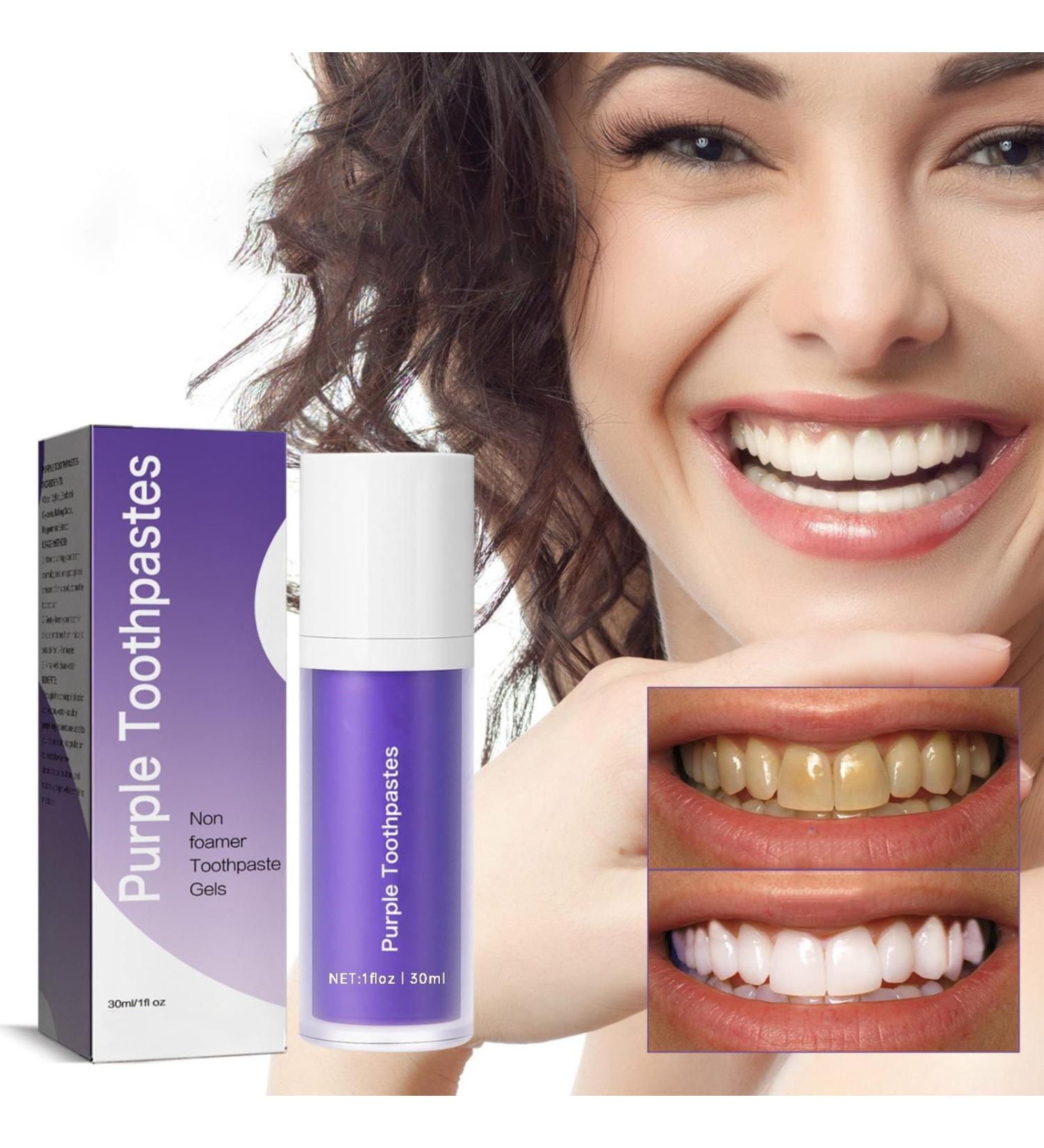 Lila Toothpaste for White Teeth - Purple Whitening Paste Tooth Stain Removal & Glowing Smile Serum - Buy Online on GoSupps.com