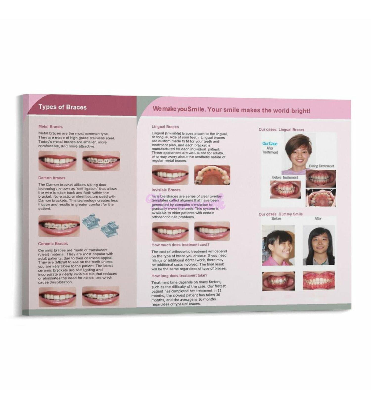 Dental Hospital Orthodontics Different Types of Braces Correct Teeth Poster (11) Canvas Painting Posters And Prints Wall Art for Living Room Bedroom Decor 30x20inch(75x50cm) Frame-style - Buy Online on GoSupps.com
