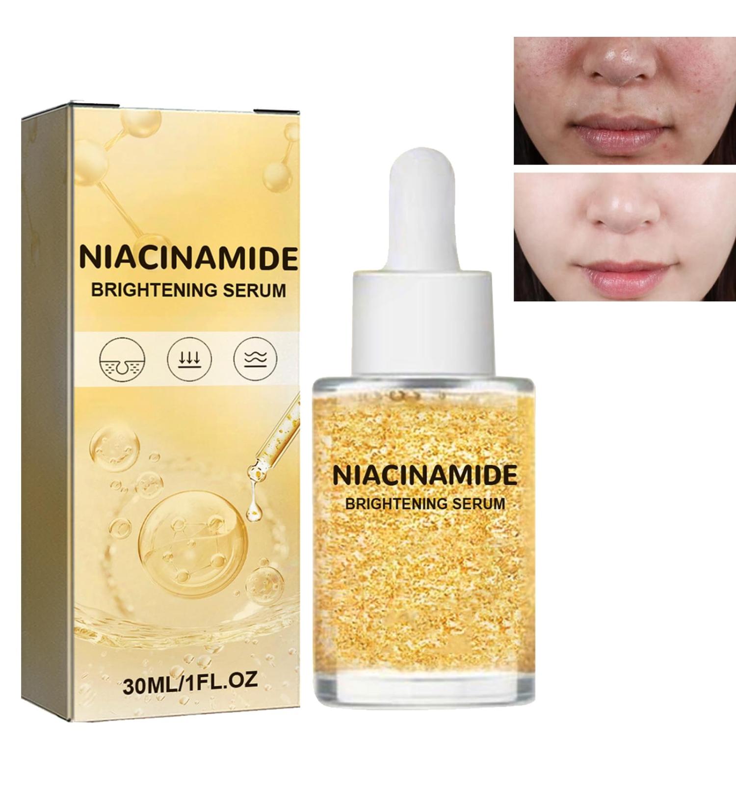 KOAHDE Nicotinamide Brightening Essence Nicotinamide Moisturizing Serum Whitening Anti-Aging Essence Moisturizing and Brightening Skin Nicotinamide Skin Brightening Essence Moisturizing & Rejuvenating - Buy Online on GoSupps.com