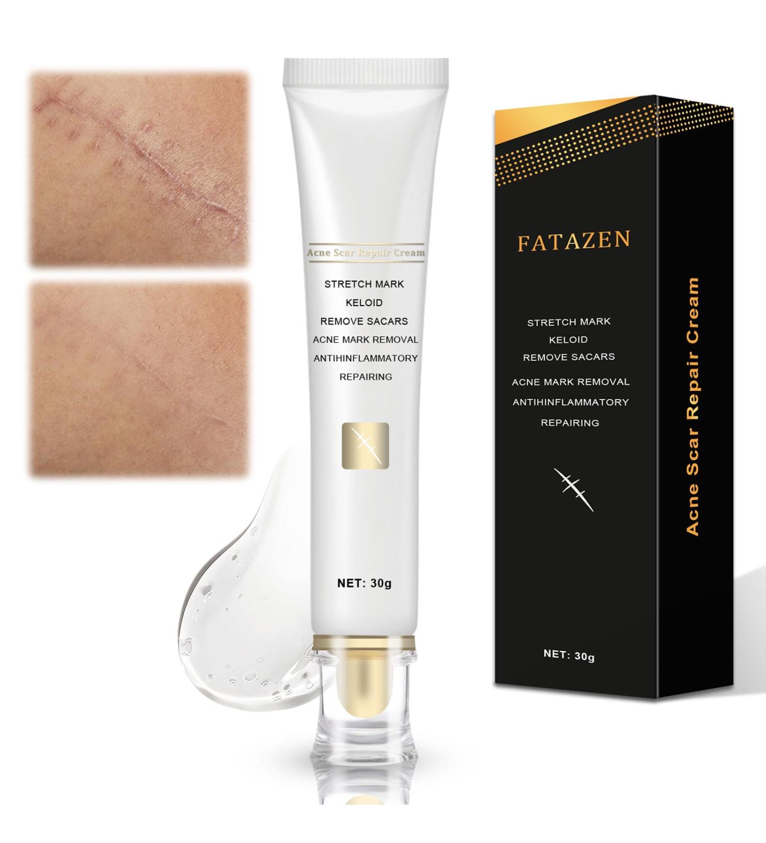 Scar Gel for Kids & Adults - Scar Cream Reduces Visibility of Scars & Decreases Tissue Tension & Itching - for All Types of Scars - Fast Absorption - Buy Online on GoSupps.com