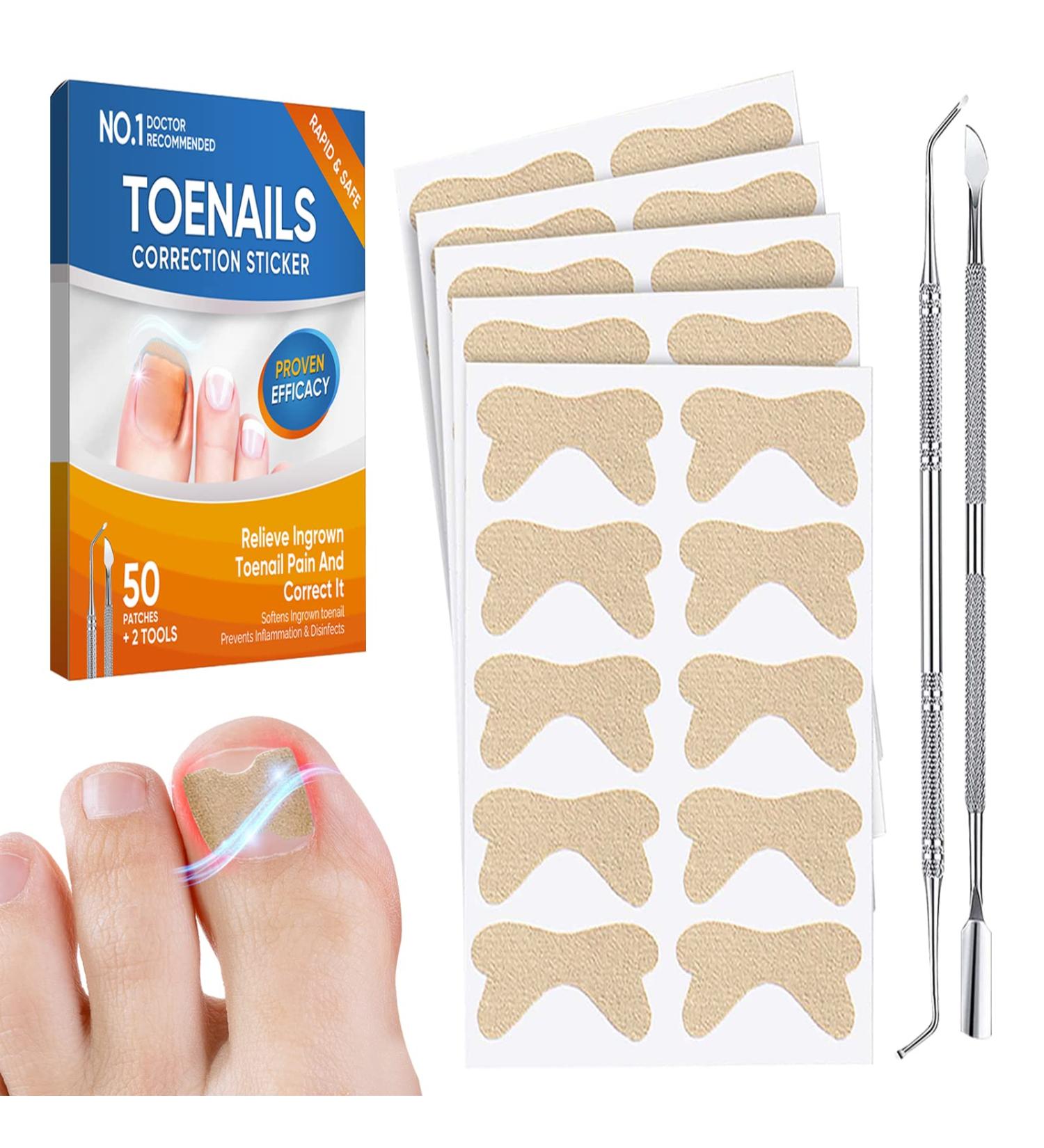 Ingrown Toenail Treatment Kit - 50Pcs No Glue Corrector Patch & Tools - Protect and Repair Ingrown Nails - Buy Online on GoSupps.com