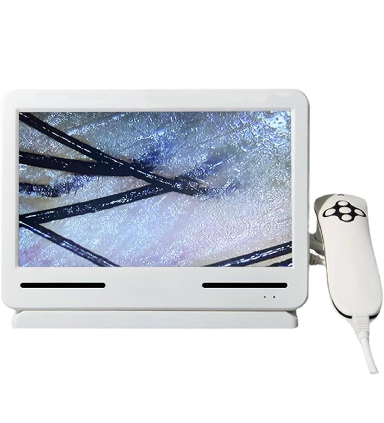 Skin Diagnosis Hair Analyzer 200X Skin Hair Scalp Detector Analyzer Skin Diagnosis Scanner System Scalp Hair Follicle Oil Moisture Magnifying Detector for Home Salon - Buy Online on GoSupps.com