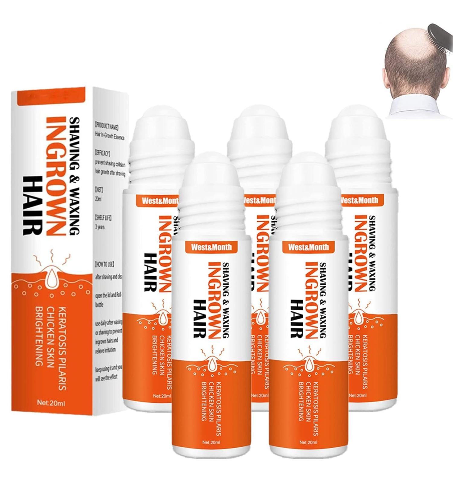 ApexFwdt Re ACT Exalted Minoxi Roll-On Hair Treatment Serum - Natural Nourishing Scalp Oil for Hair Growth and Repair - Women & Men - Buy Online on GoSupps.com