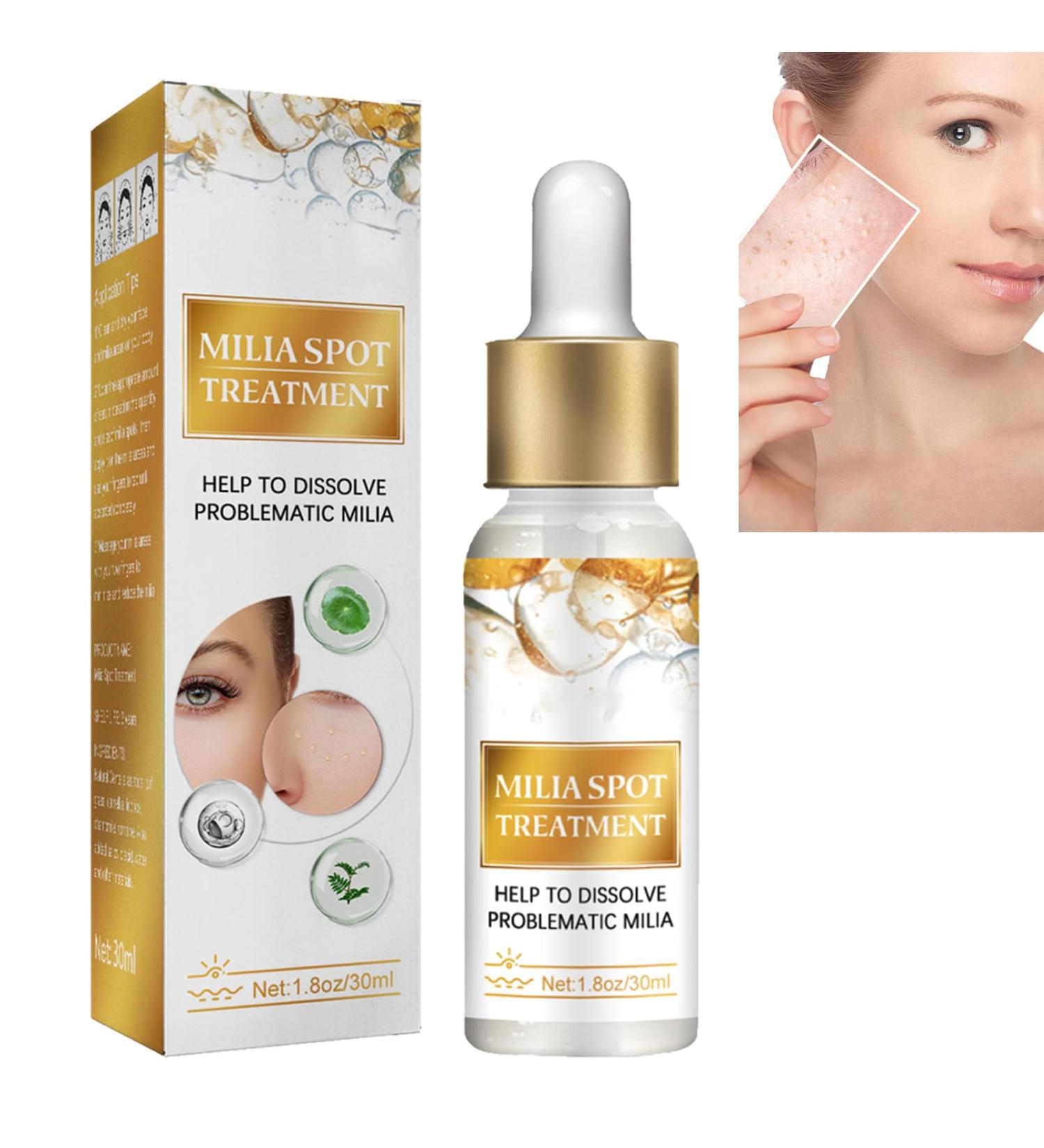 Milia Remover Milia Removal Spot Care Milia Spot Serum for Face Milia Spot Remover Milia Treatment Spot Remover for Face Helps Dissolve and Reduce Milia Nourish Skin Care - Buy Online on GoSupps.com