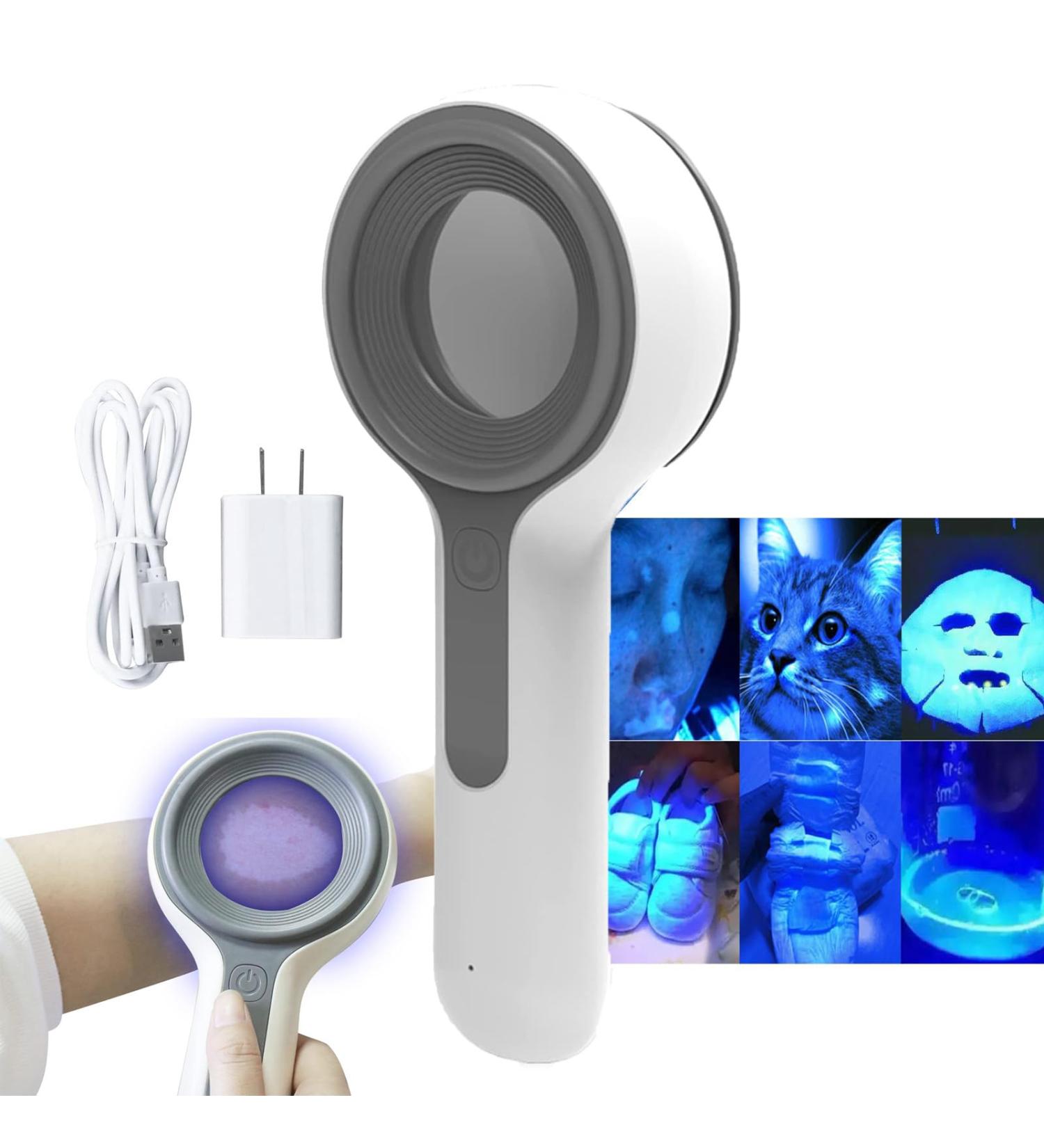 Woods Lamp Skin Analyzer Professional Magnifying Analyzer Rechargeable Skin Detector Home Care for Pet Fungus Detection Baby Product Detection Cosmetic Fluorescent Agent - Buy Online on GoSupps.com