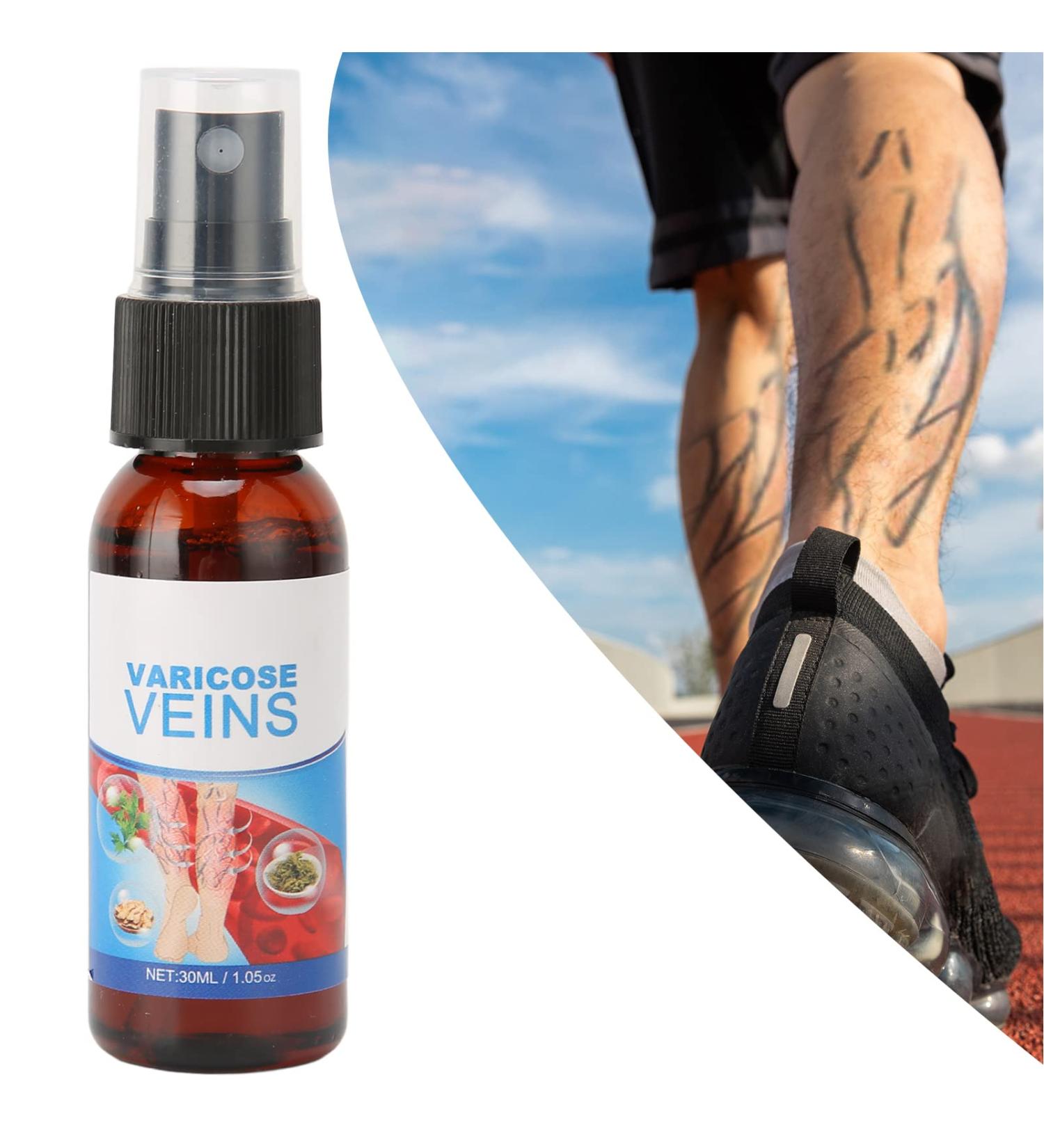 30ml Varicose Veins Treatment Spray | Massage Care Solution for Smooth Vein Bump | Activate Leg Meridians - Buy Online on GoSupps.com