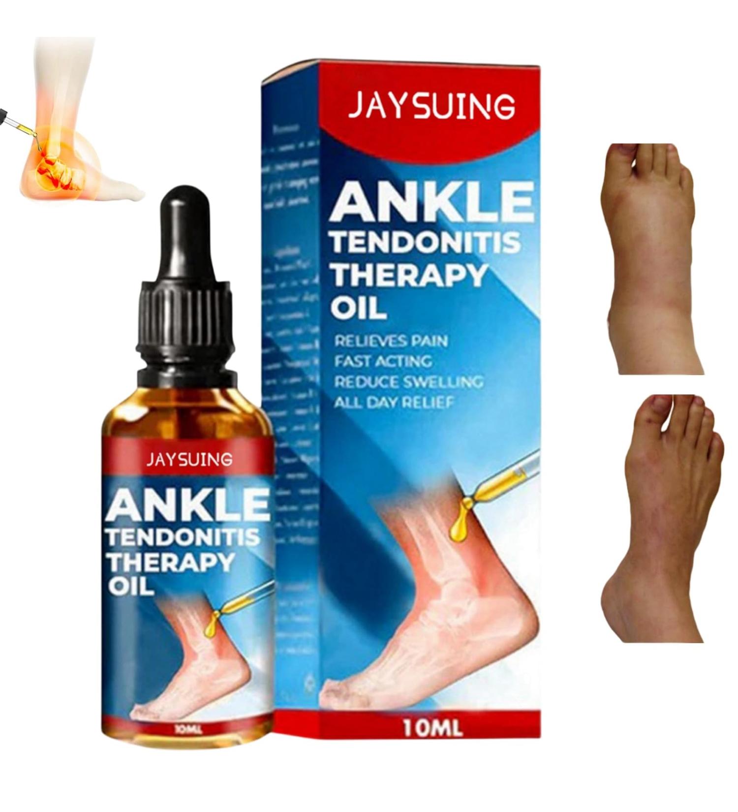 Ankle Therapy Oil for Pain Relief and Swelling Treatment - Joint & Muscle Pain Relief Gel for Swollen Feet and Ankles - Buy Online on GoSupps.com