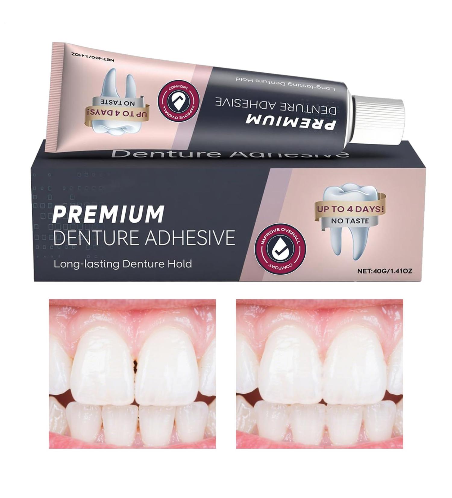 Adh sif Pour Dentier - Colle Dentaire Fixation Forte | Soin Confortable Doux avec Scellage tanche pour Grand-P re Grand-M re Famille Femmes Hommes Amis Adultes - Buy Online on GoSupps.com