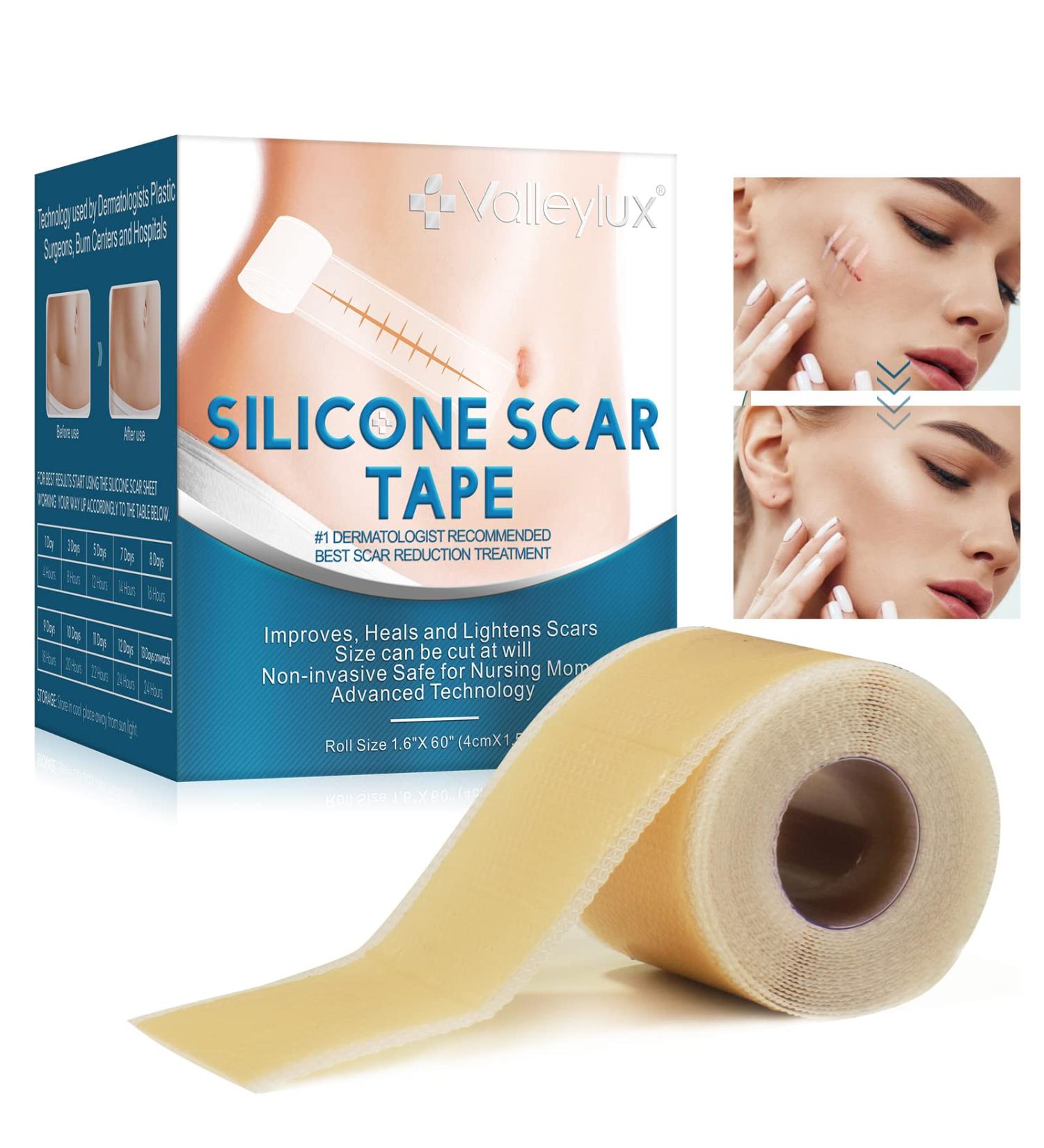 Silicone Scar Tape Roll (1.5M) - Medical-Grade Professional Strips for Surgical Scars & C-Section Surgery - Buy Online on GoSupps.com