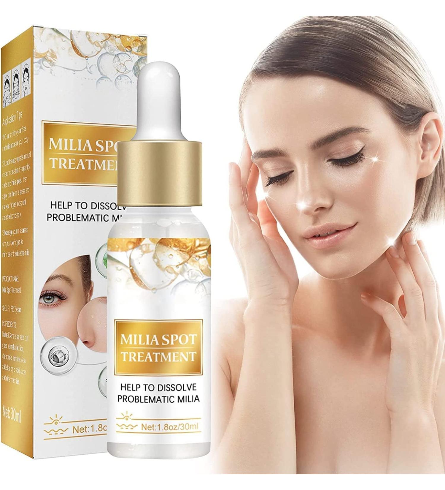 Huile essentielle pour les yeux pour liminer les taches Milia estomper les cernes dissoudre et r duire le milia - Essence de granul s de graisse - limine les taches sombres de la peau - Am liore - Buy Online on GoSupps.com