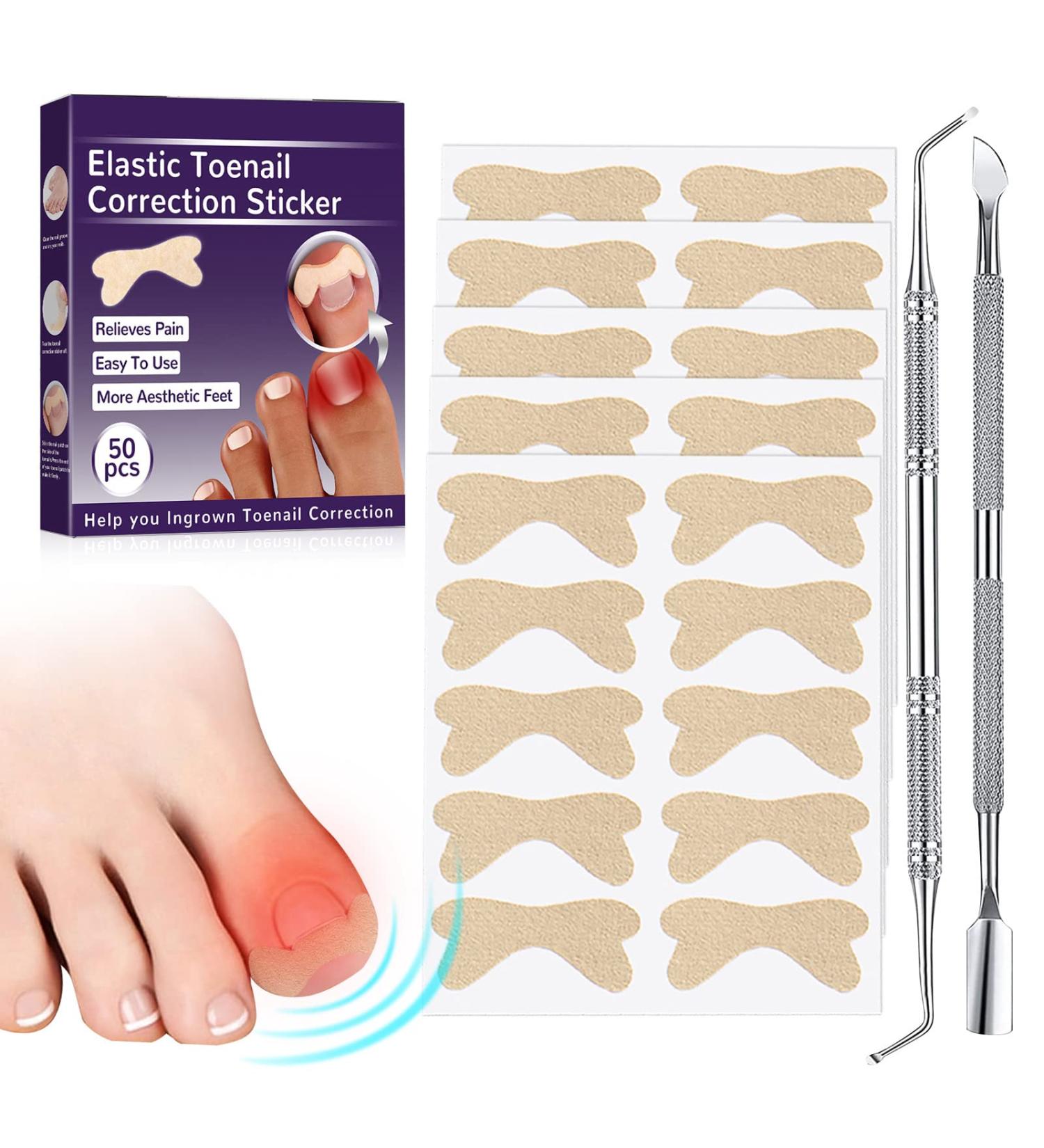 Glue-Free Ingrown Toenail Corrector Patch - 50 Pcs | Treatment Tool for Ingrown Toenails - Buy Online on GoSupps.com