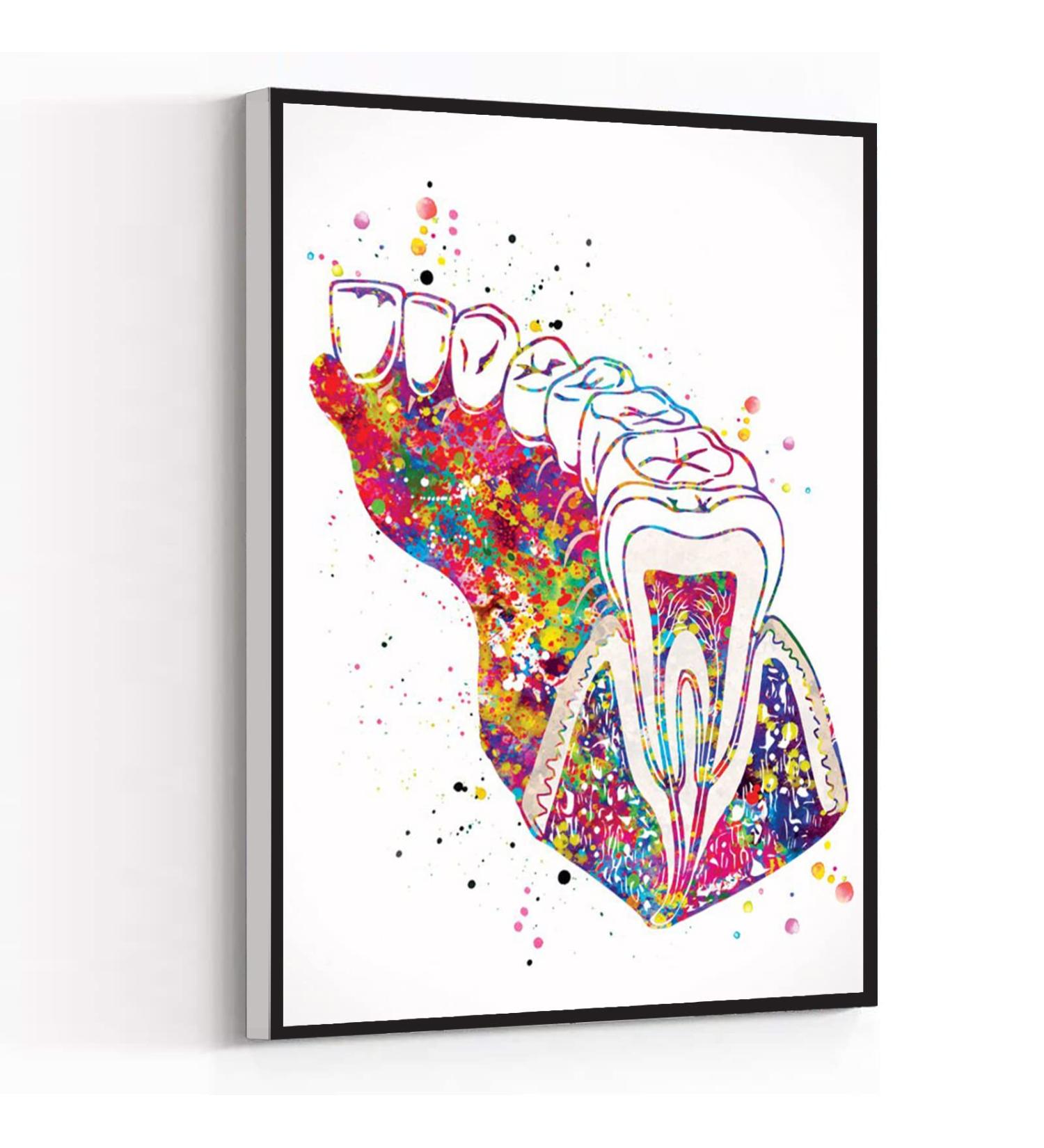 Molar Tooth Section Diagram Watercolor Print Human Teeth Dental Office Clinic Decor Art Dentistry Dentist Gift Dental Hygienist Hanging Wall Decor 8X12 Inch Framed Modern Canvas Wall Art - Buy Online on GoSupps.com