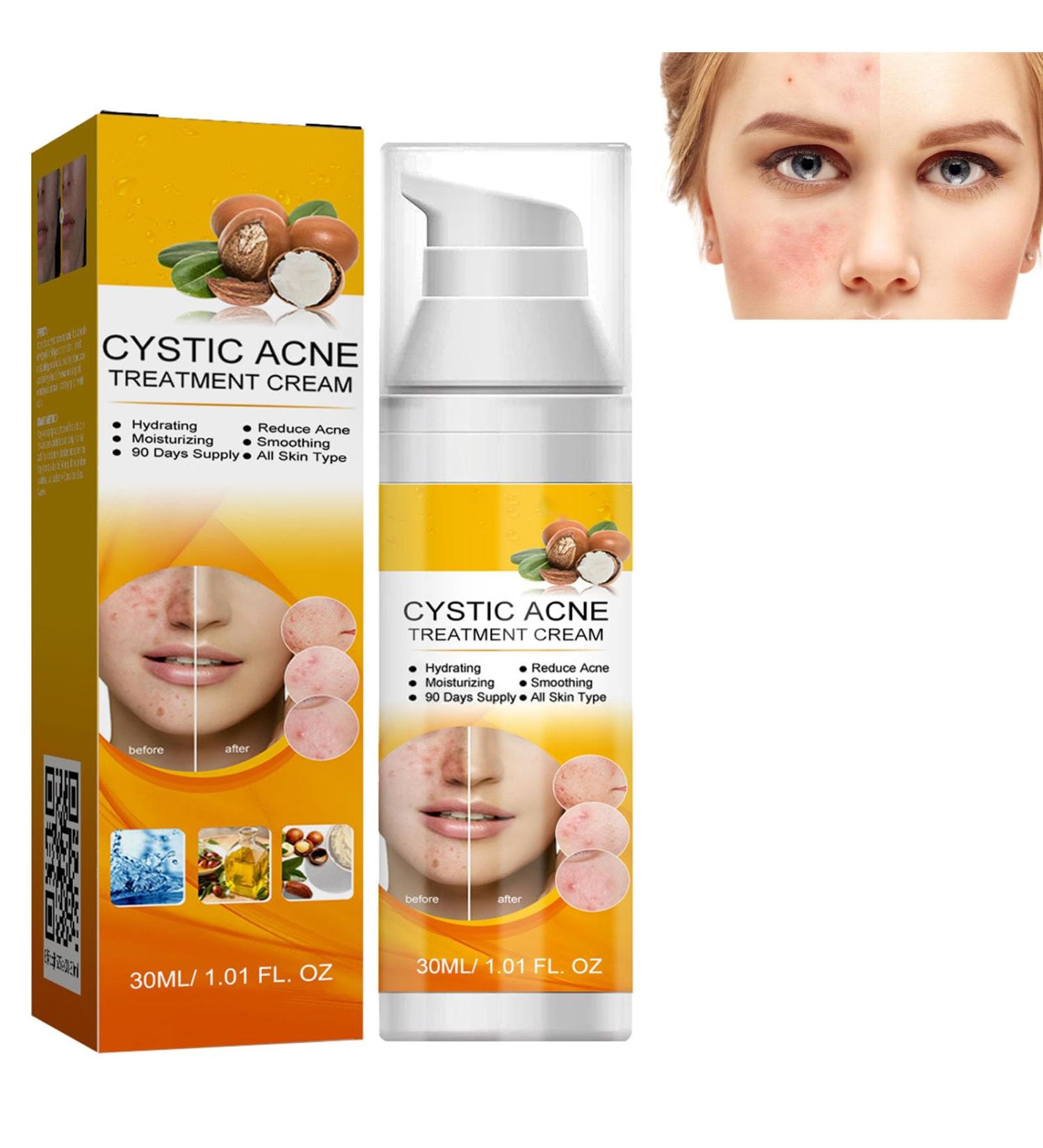 KOAHDE Facial Anti Acne Essence Acne Essence Anti Acne Hydrating Essence Anti Acne Facial Serum Acne Treatment Serum Serum Skin Smoother Acne Removing Moisturizing Serum Skin Rejuvenation Serum - Buy Online on GoSupps.com