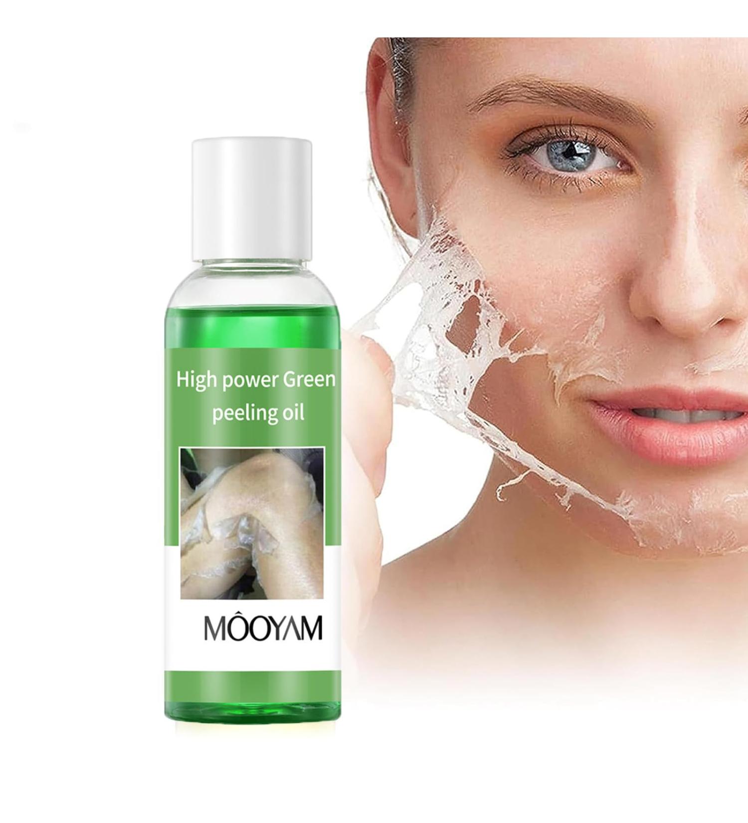 Extra Strength Peeling Oil for Dark Skin - 110ML | Chemical Peel for Face Hands & Feet - At Home Treatment - Buy Online on GoSupps.com