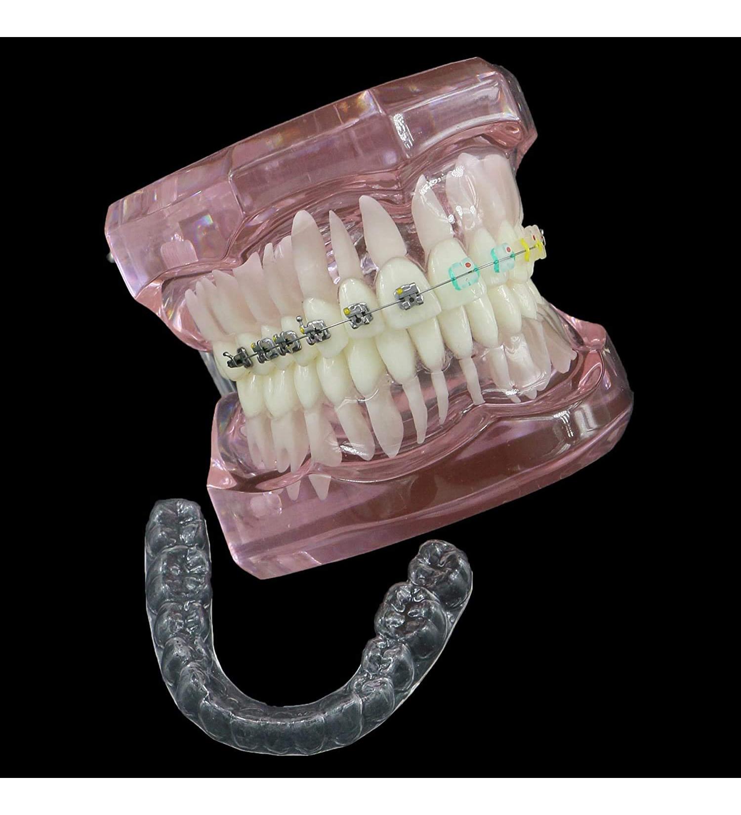 HDGRNCC Dental Orthodontic Brackets Model - Metal Ceramic Self-Ceramic Bracket for Training | International Shipping - Buy Online on GoSupps.com