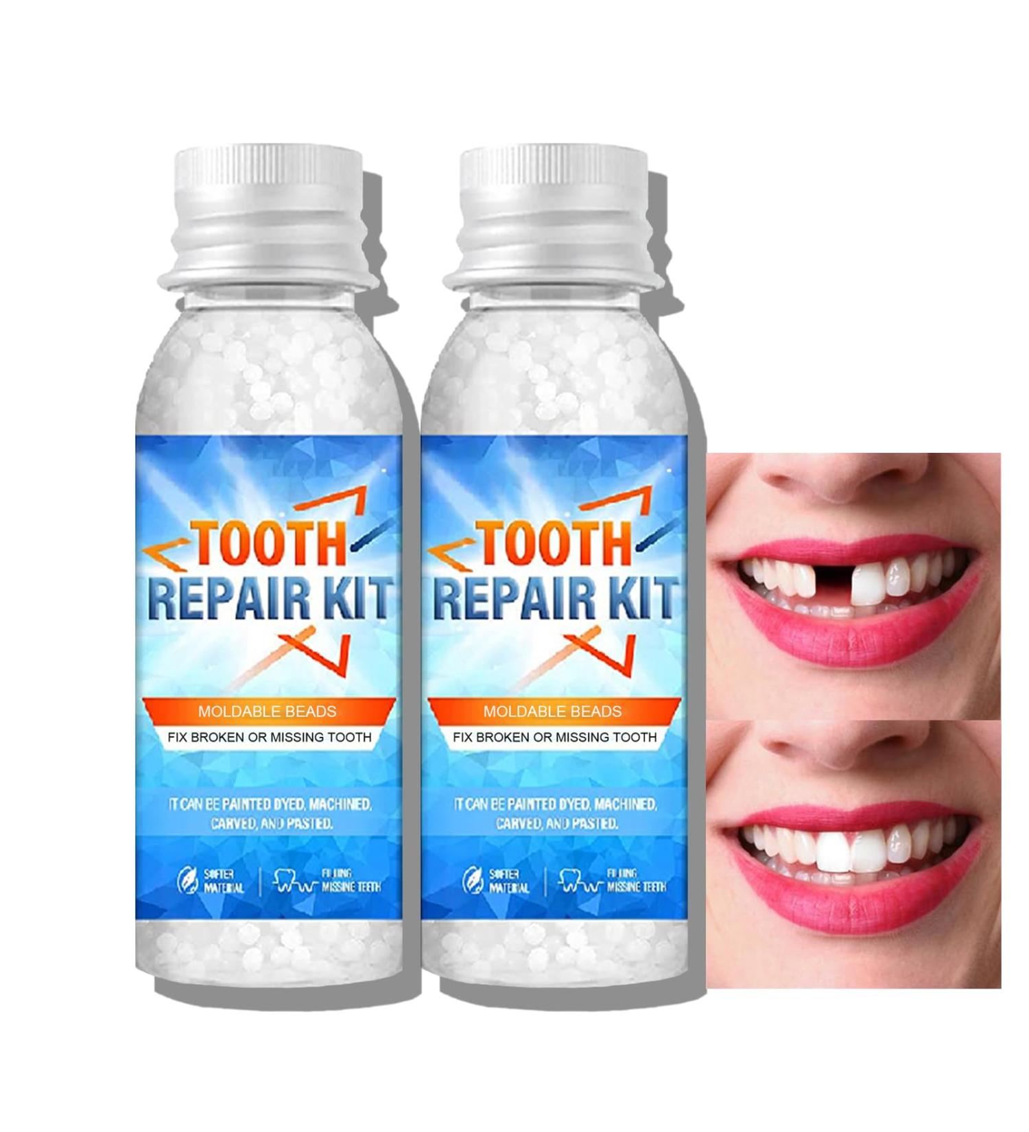 Tooth Filling Repair Kit Temporary Tooth Filling Kit with 4 Professional Tools Teeth Repair Kit with False Teeth for Tooth Replacement Tooth Repair Granules for Missing (Temporary Tooth Filling 2pcs)