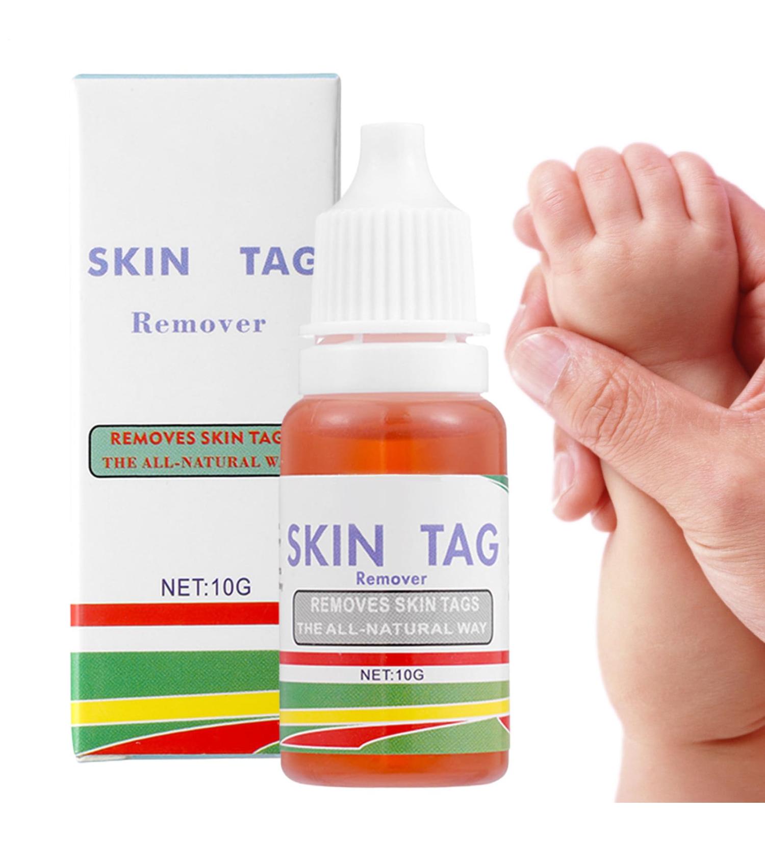 Mole Remover for the Body - 25g Blemish Correcting Liquid Solution | Mole Removal Solution - For Women At Home While Traveling Routine - Buy Online on GoSupps.com