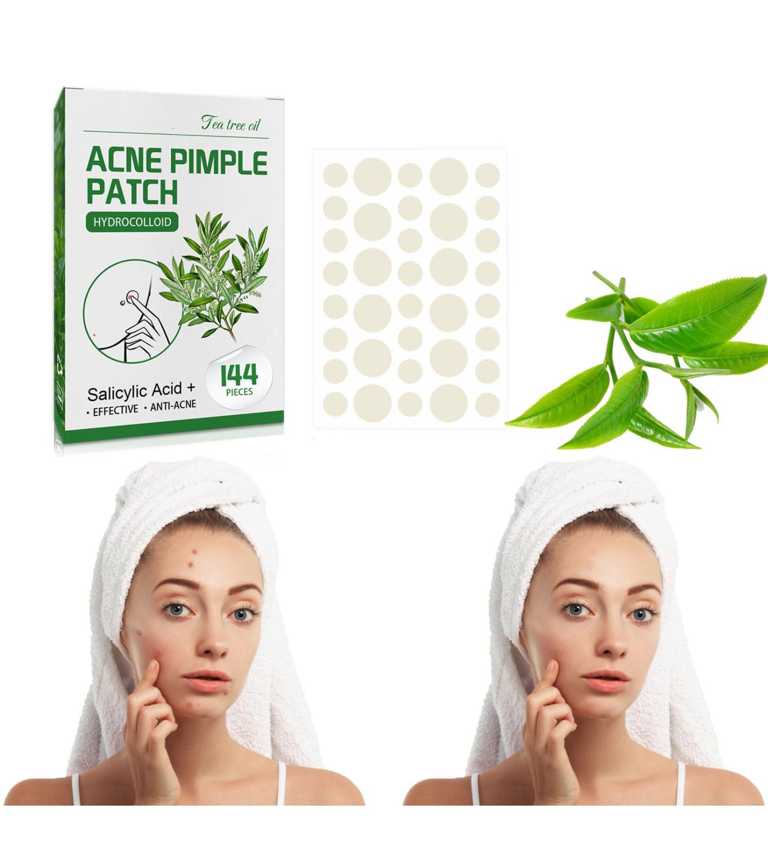 Nmbol Acne Patch Colorful 3 - Buy Online on GoSupps.com