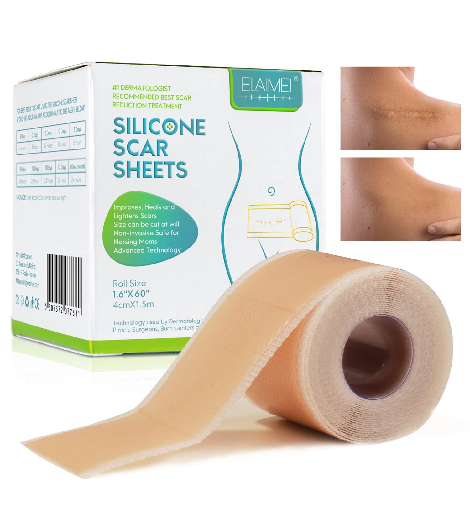 Medical Grade Silicone Scar Tape - 4CM x 150CM | Effective Scar Removal & Reusable for Keloid, Surgery & Acne - Waterproof & Soft Silicone Strips - Buy Online on GoSupps.com