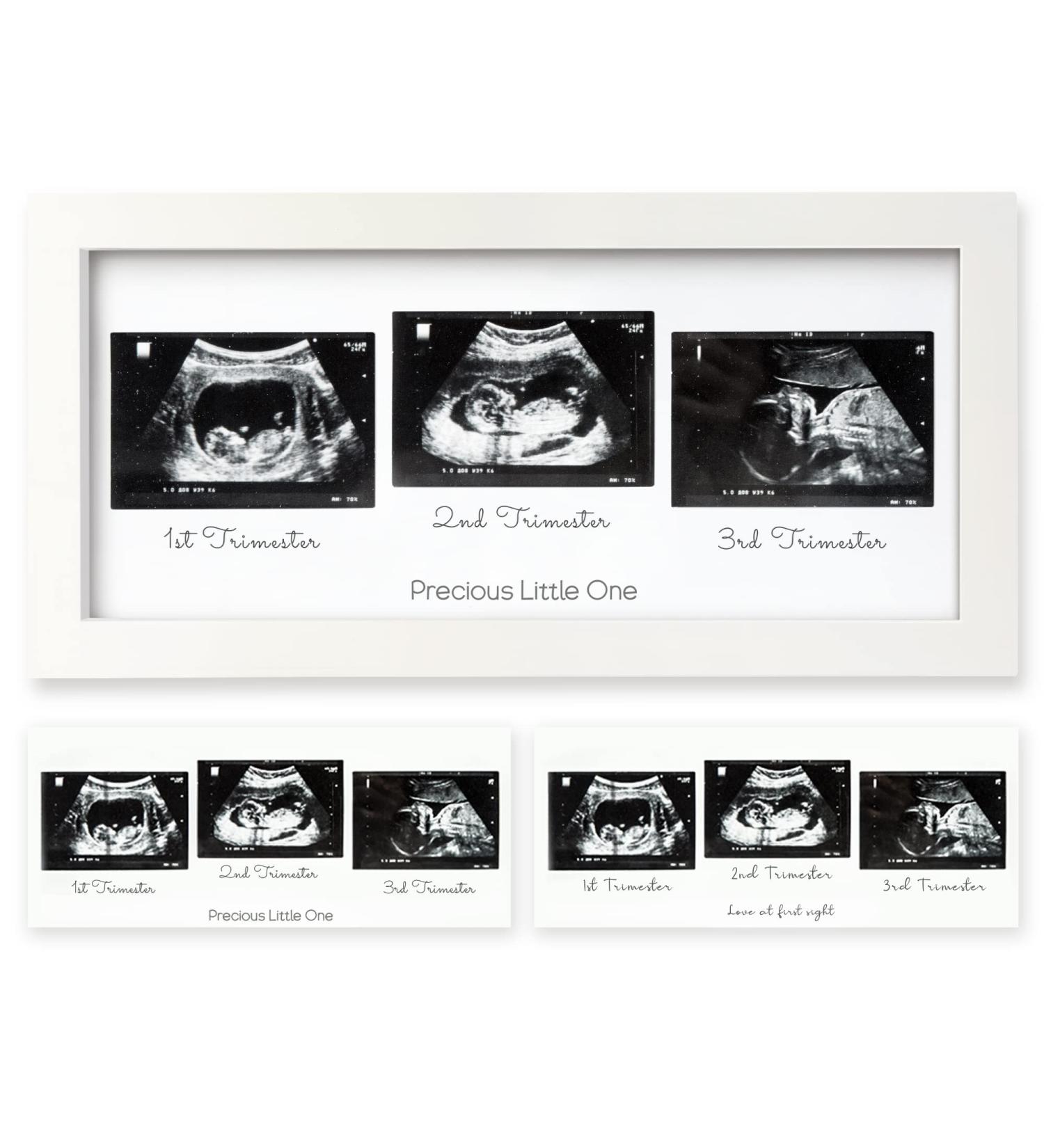Sonogram Picture Frame Trio - Ultrasound Frames for Mom to Be - Baby Nursery Decor - Pregnancy Announcement Gift - Pregnant Mom Gifts (Alpine White) - Buy Online on GoSupps.com