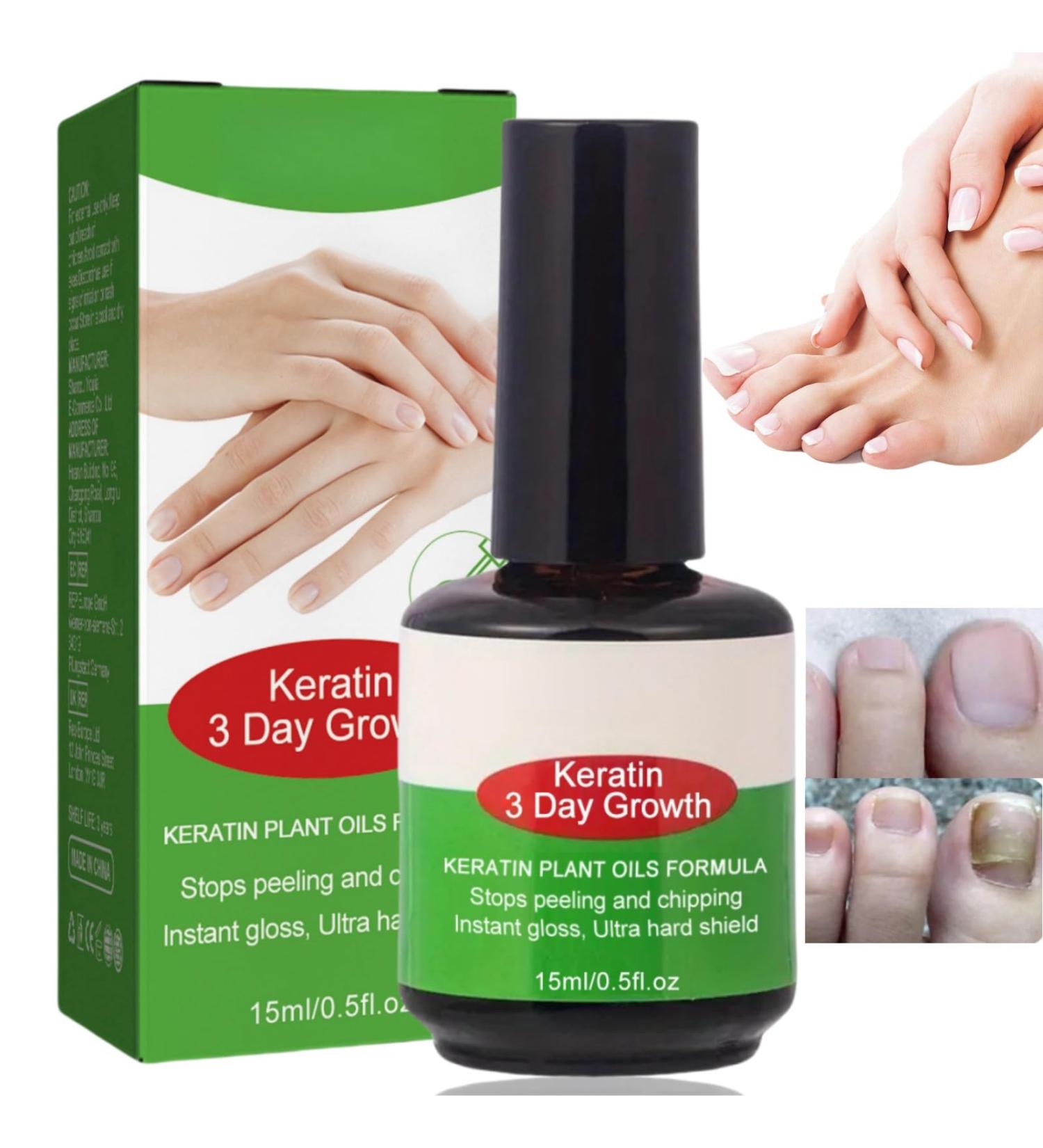 15ml Keratin 3 Days Growth Nail Treatment&Strengthener Nail Growth Treatment for Nail Repair Nail Strengthener for Damaged Nails Extra Strong Growth Nail Polish Nail Oil Treatment for Damaged Nails - Buy Online on GoSupps.com