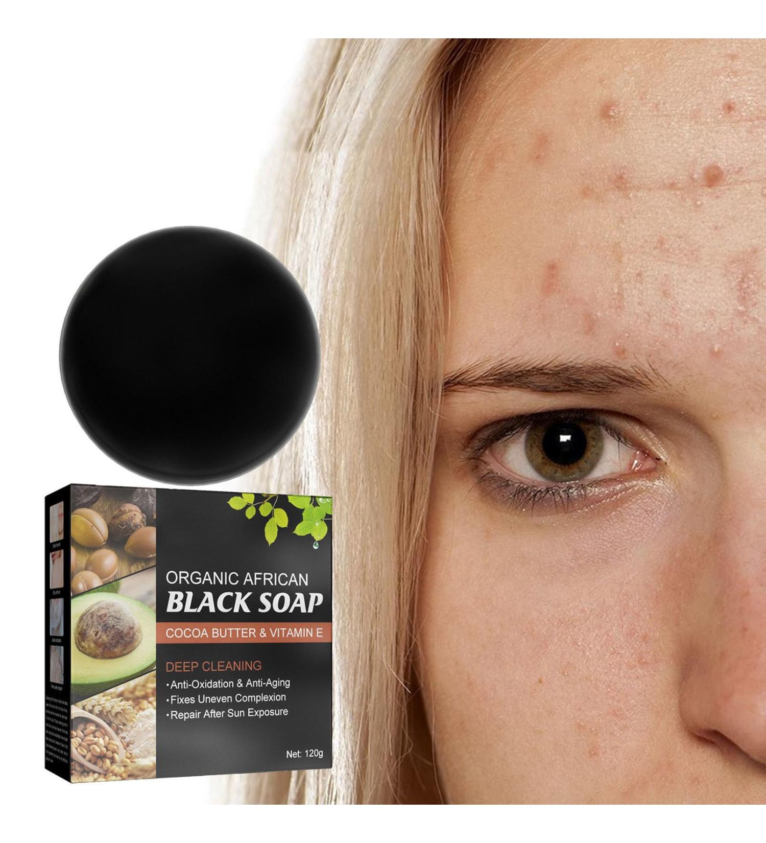 Nmbol Skin Acne Soap Soap for Removal of Black Spots ening Soap for Dark Skin Natural Soap Face Body Fixed Facial Cleaning Vegan For All Skin Types - Buy Online on GoSupps.com