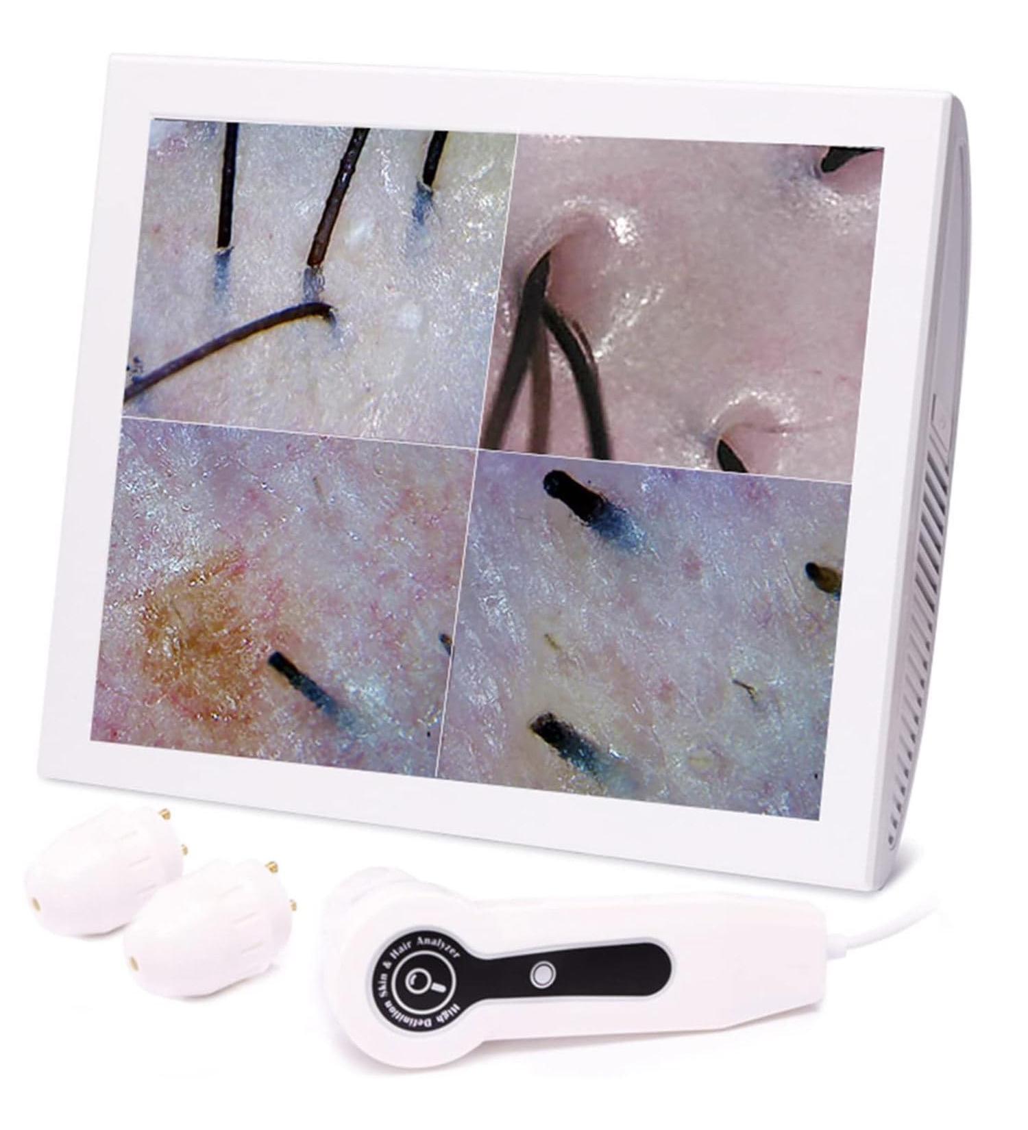 DAZULI Analyseur de Cheveux de Peau d tecteur de Cuir chevelu de Cheveux de Peau 50X 200X Instrument de Soin de Peau de d tecteur de follicule pileux de 12 Pouces Machine d'analyseur de Cheveux - Buy Online on GoSupps.com