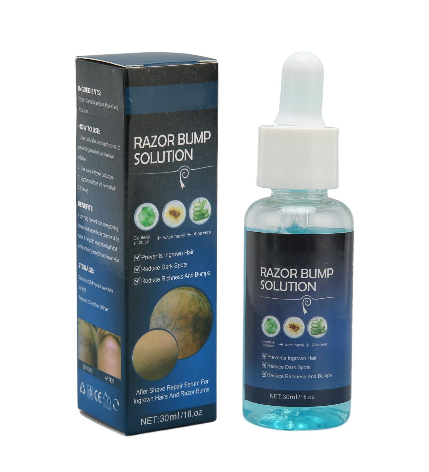 Ingrown Hair Treatment - 30ml Razor Bumps Solution | Mild Moisturizing After Shave Repair Serum for Men - Buy Online on GoSupps.com