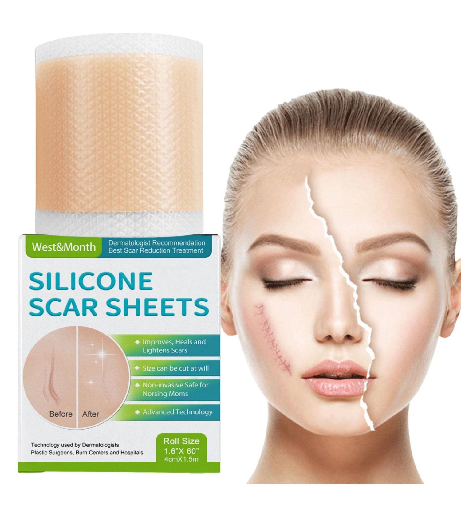 Teksome Scar Tape for Body - 1.5m Stretch Mark Remover Strips | Silicone Gel Tape for Scars & Stretch Marks - Buy Online on GoSupps.com