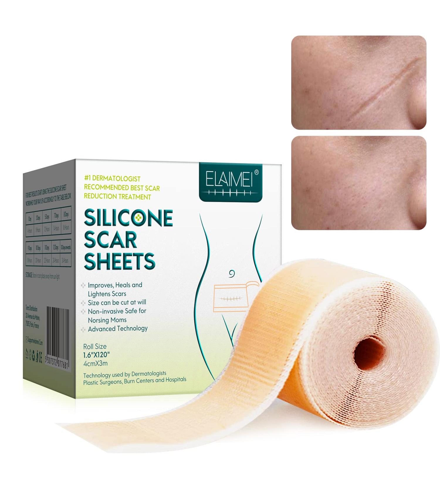 Reusable Silicone Scar Sheets | Softens & Repairs Scars | for Injuries, Burns, Acne, C-Section, Stretch Marks | Washable | 1.6 x 120 - Buy Online on GoSupps.com