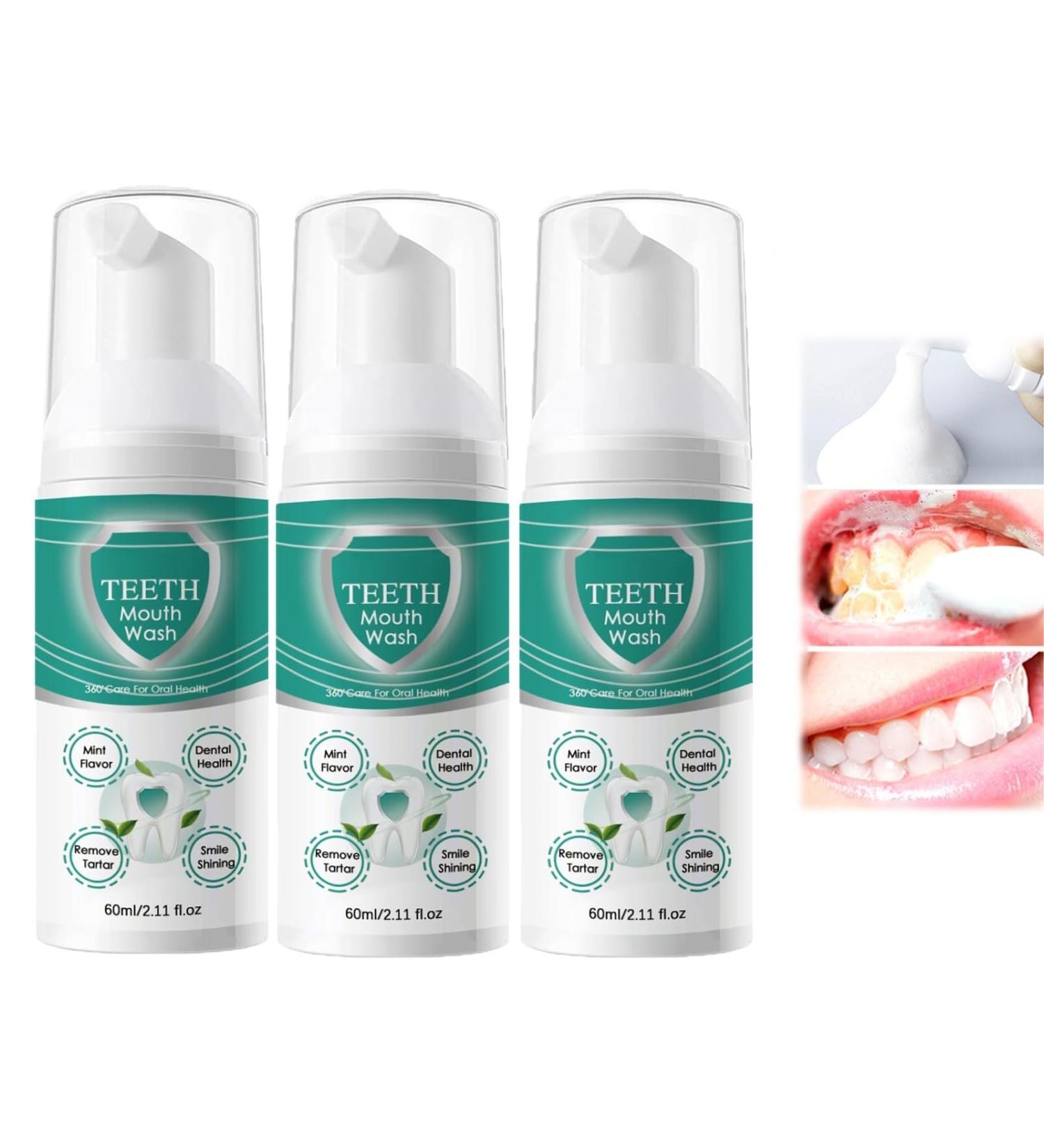 Awzlove Teeth Total Care Mundwasser - Best 2024 Toothedwater Foam for Oral Health (3PCs) - Buy Online on GoSupps.com